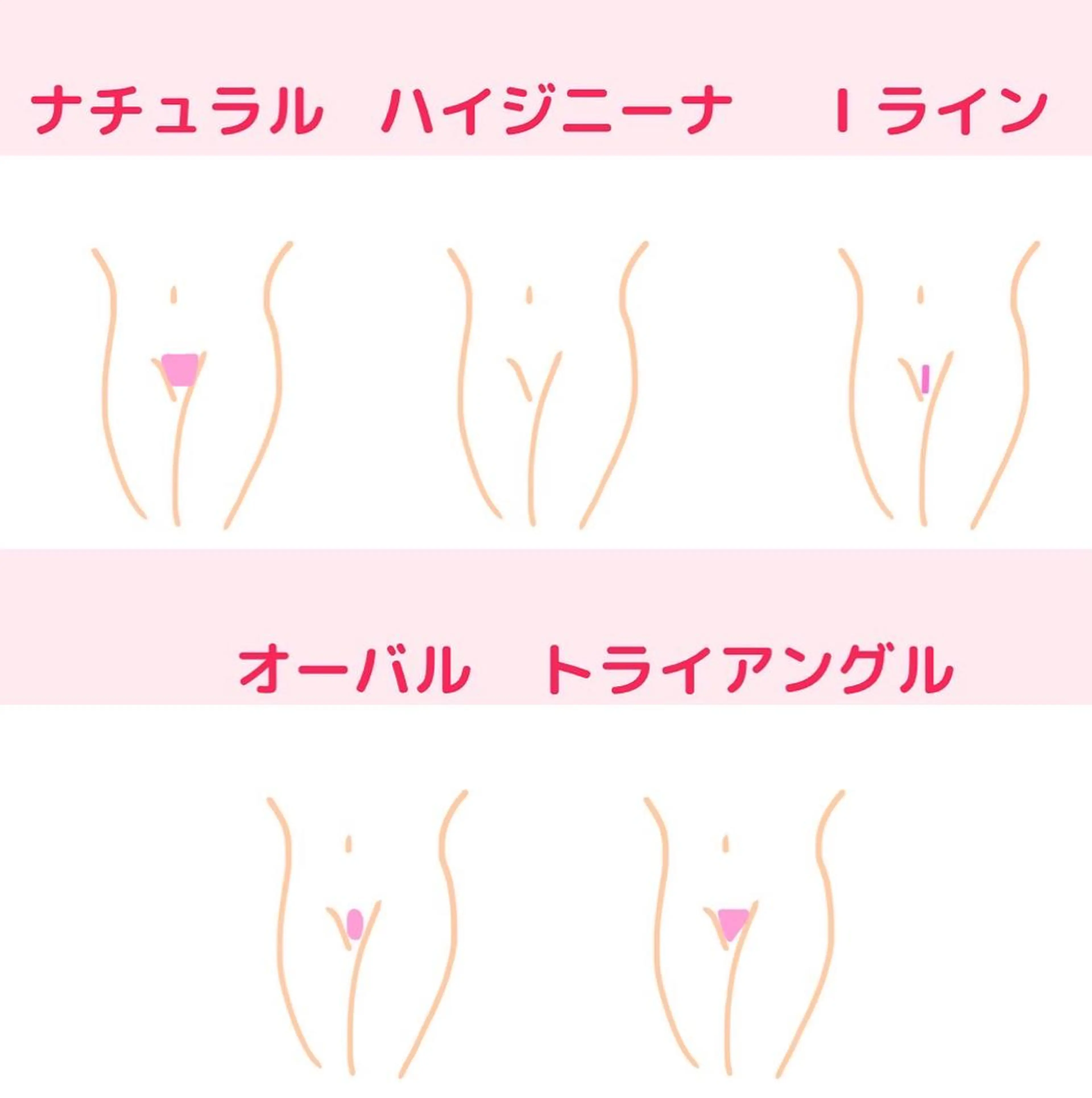 【VIO 脱毛】何度通ってもこの価格の写真