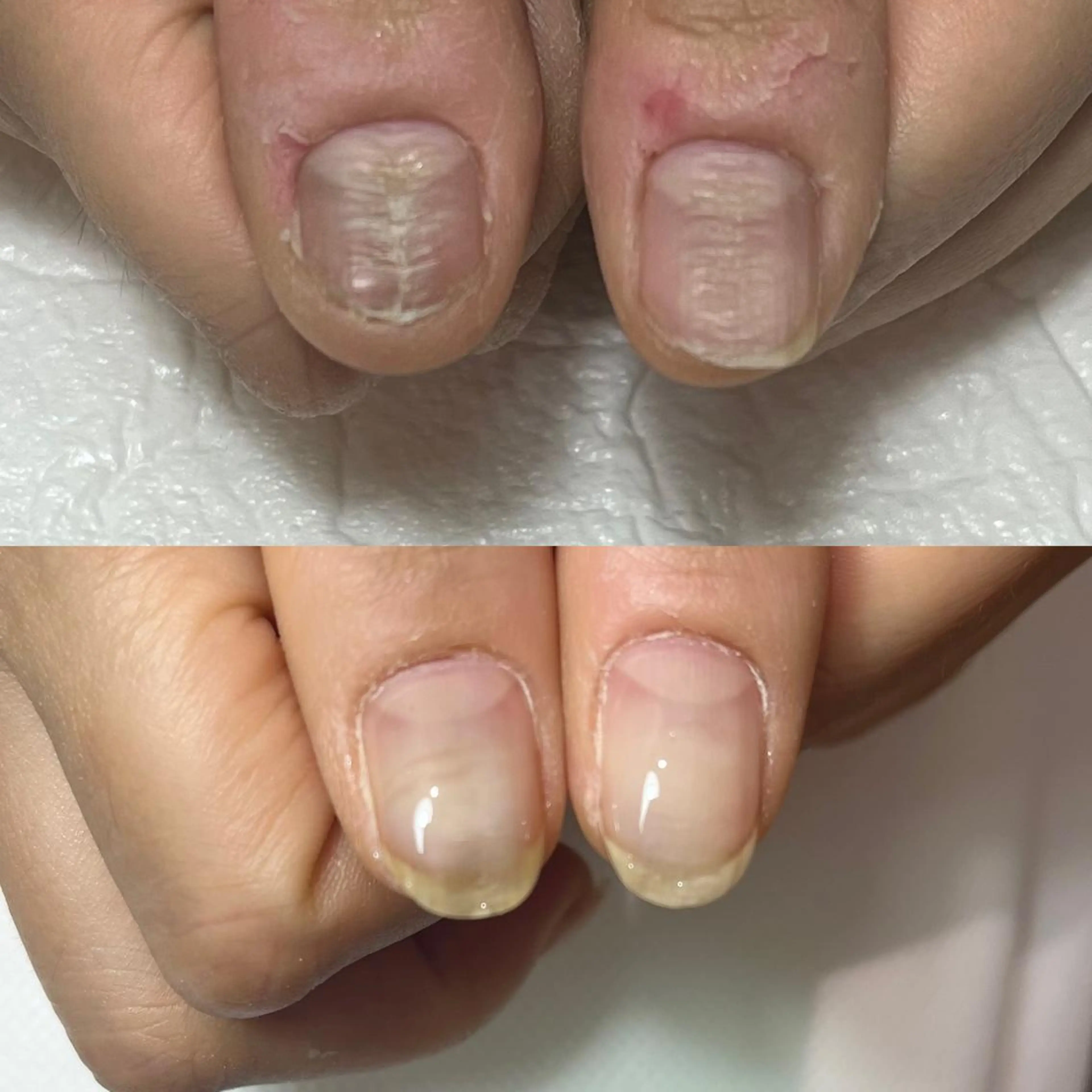 ネイル アートネイル クリアネイル ジェルネイル パラジェル 自爪育成・巻き爪 補正講師　津蔵のネイルデザイン