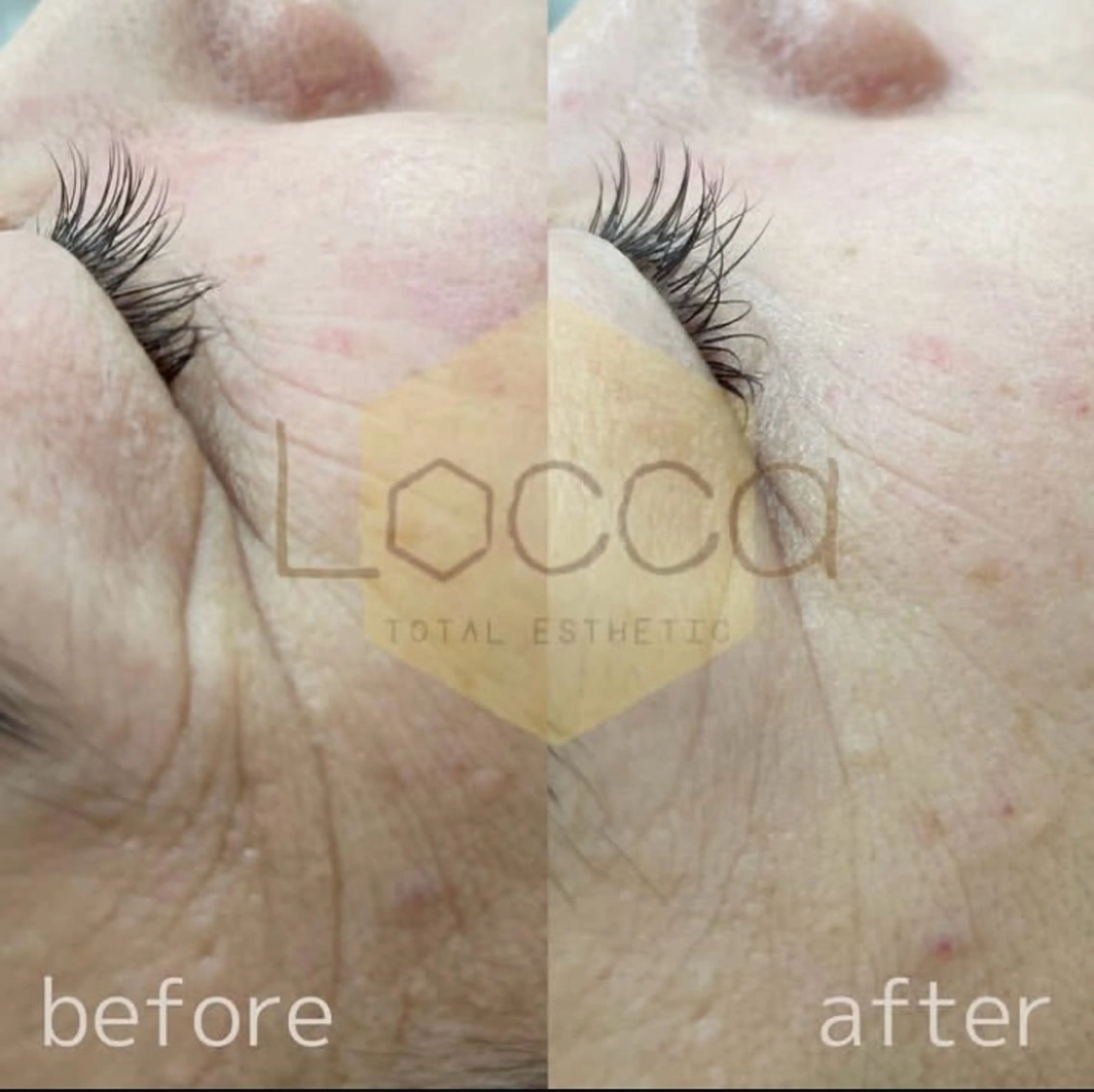 エステティック ロッカのエステ・リラクイメージ