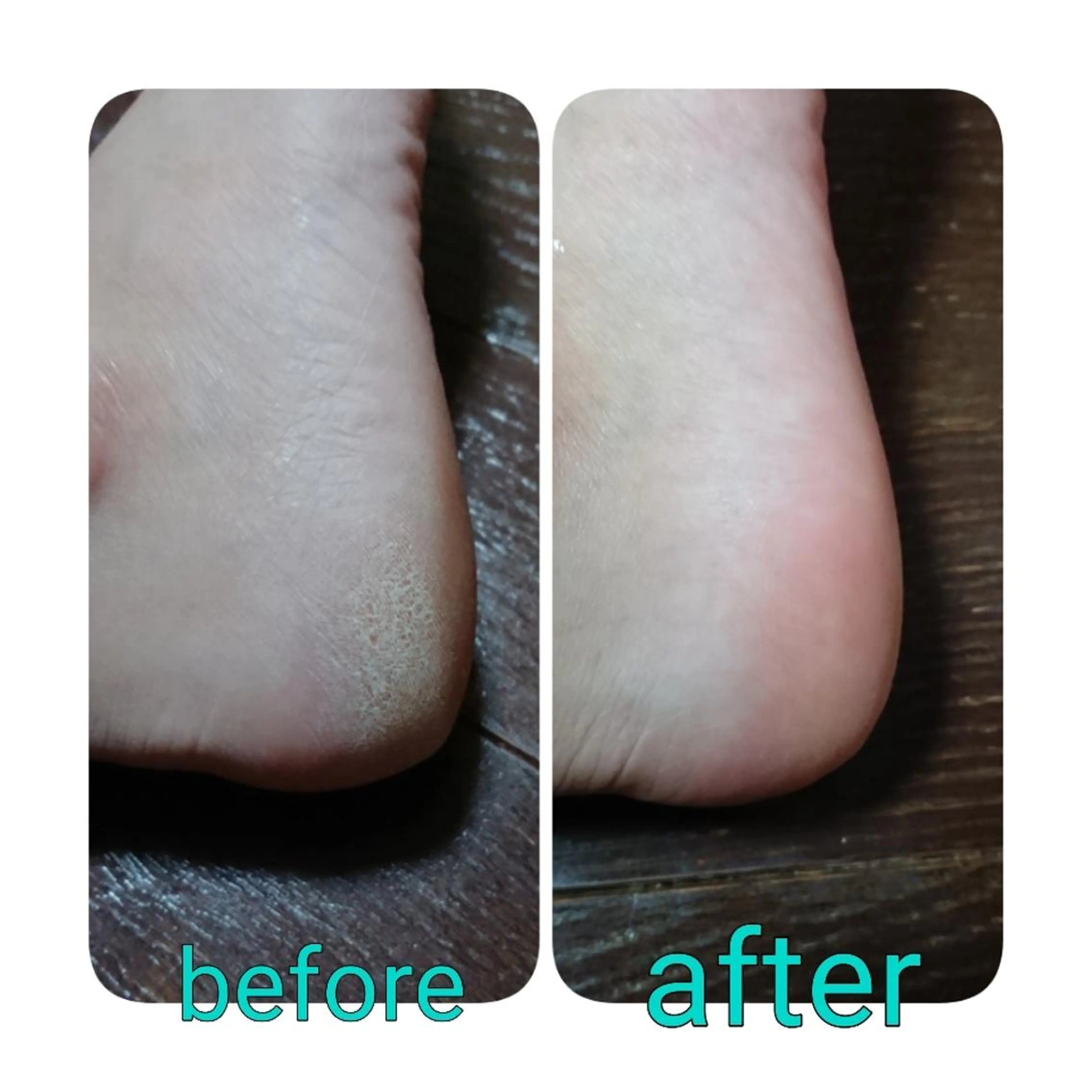 ネイル 市川駅 ✿中津のネイルデザイン