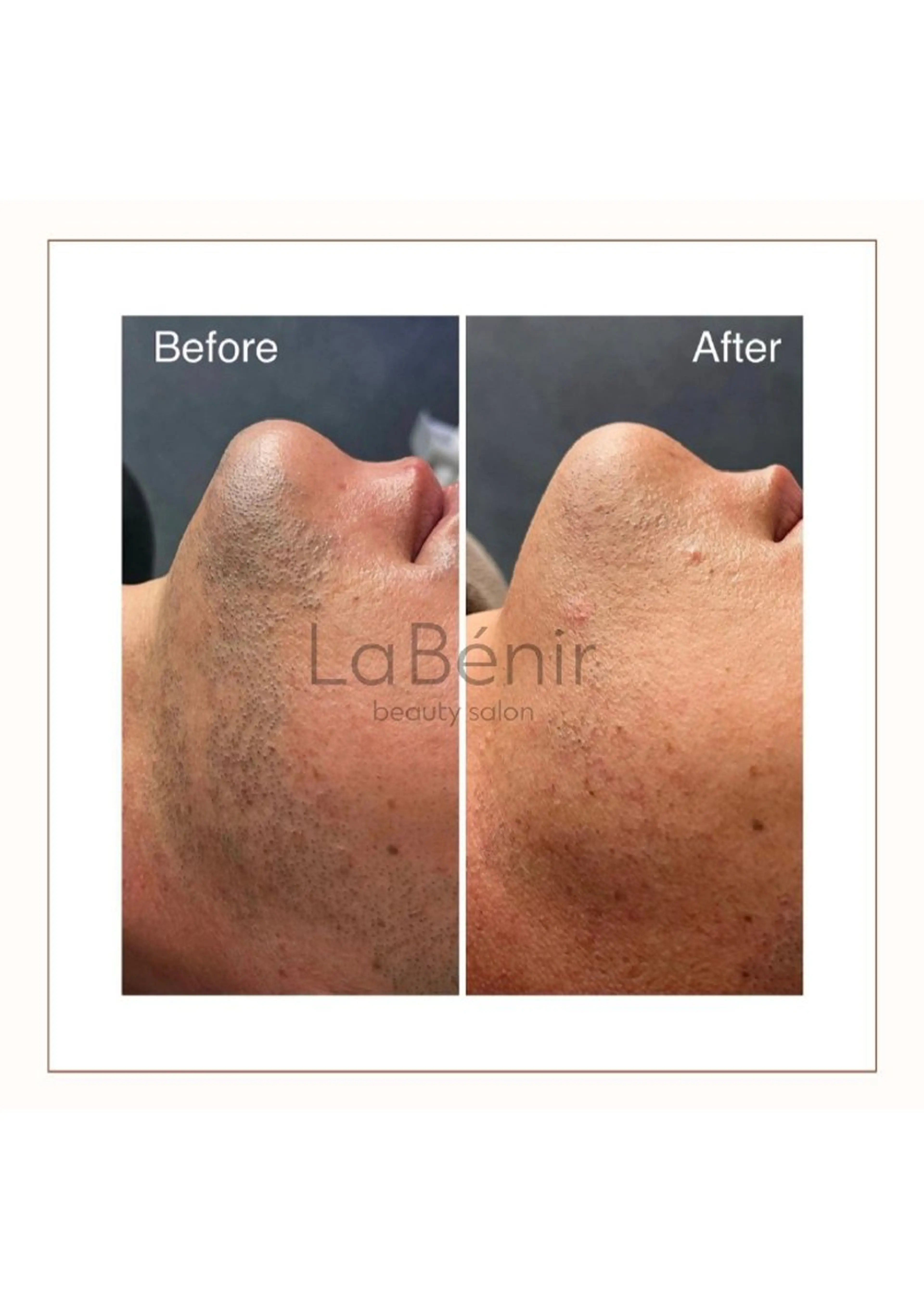 メンズ 脱毛/美肌【皮膚科看 護師経営】ラベニールのエステ・リラクイメージ