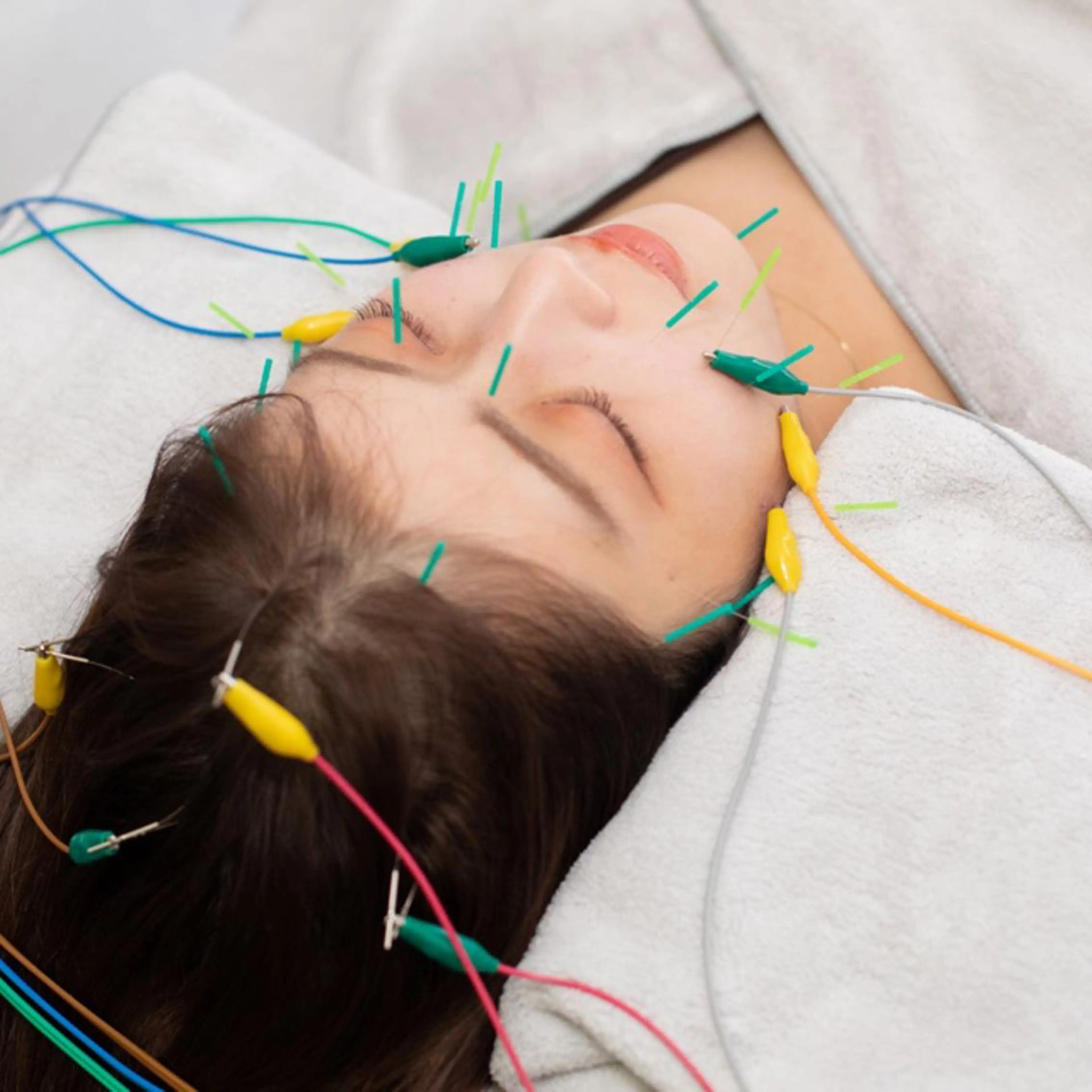 新宿hari-me所属・美容鍼hari-me 新宿のエステ・リラクイメージ