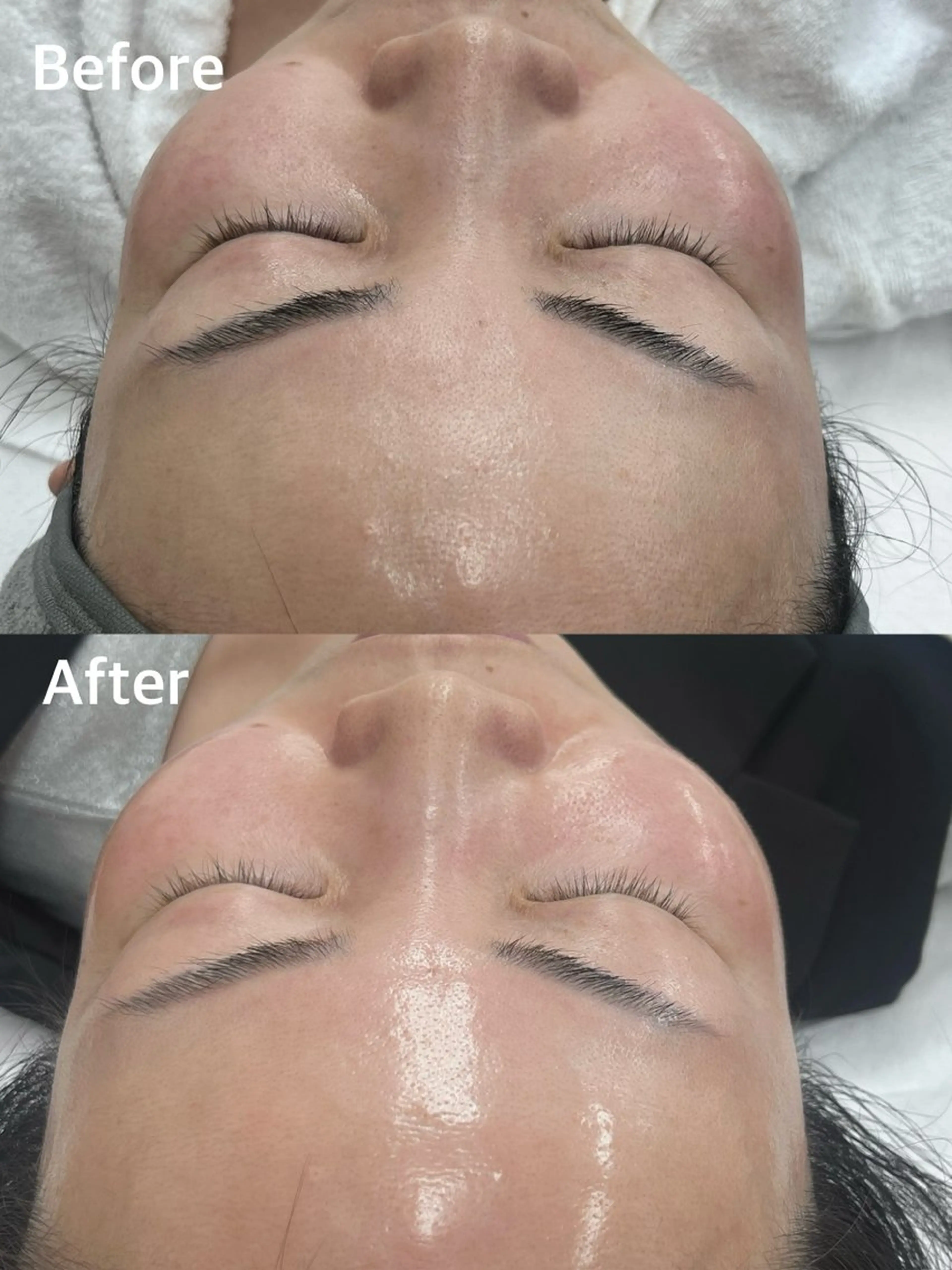 小顔専門看護師クリニカルサロンCOCO所属・小顔と美肌サロン クリニカルサロンココのエステ・リラクイメージ