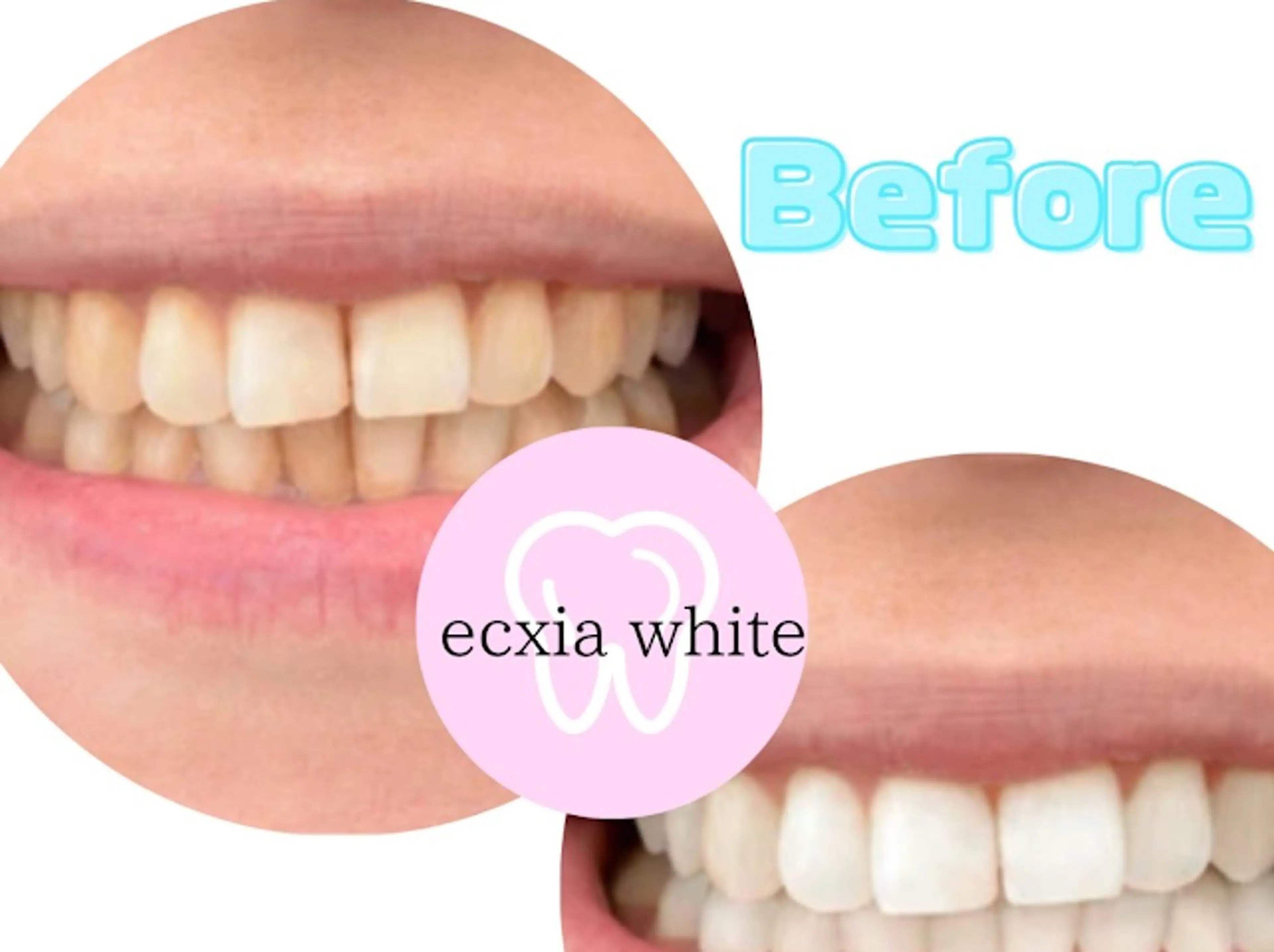 その他 セルフホワイトニング エクシア浜松店のエステ・リラクイメージ