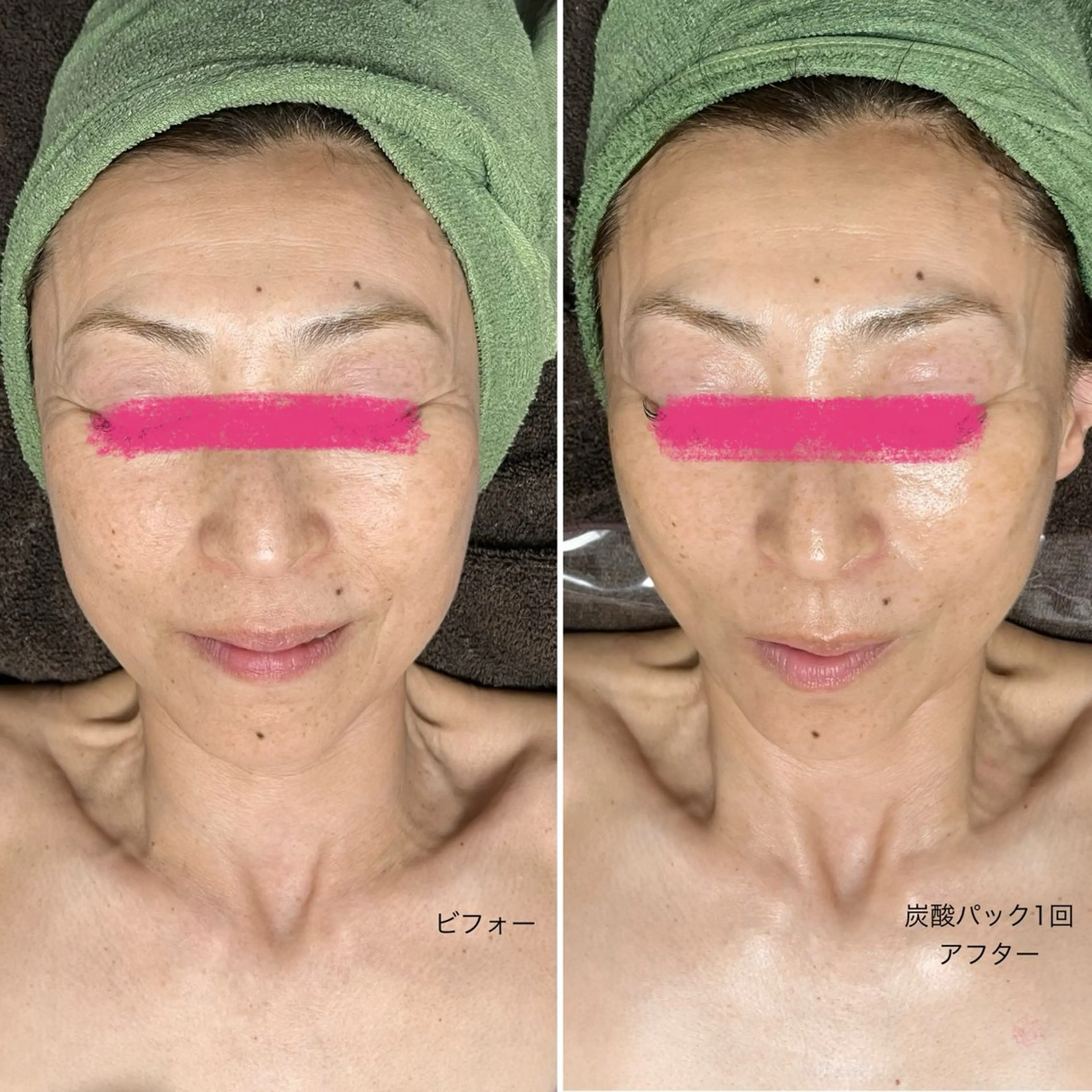 SlowGarden 体質肌質改善サロンのヘアスタイル