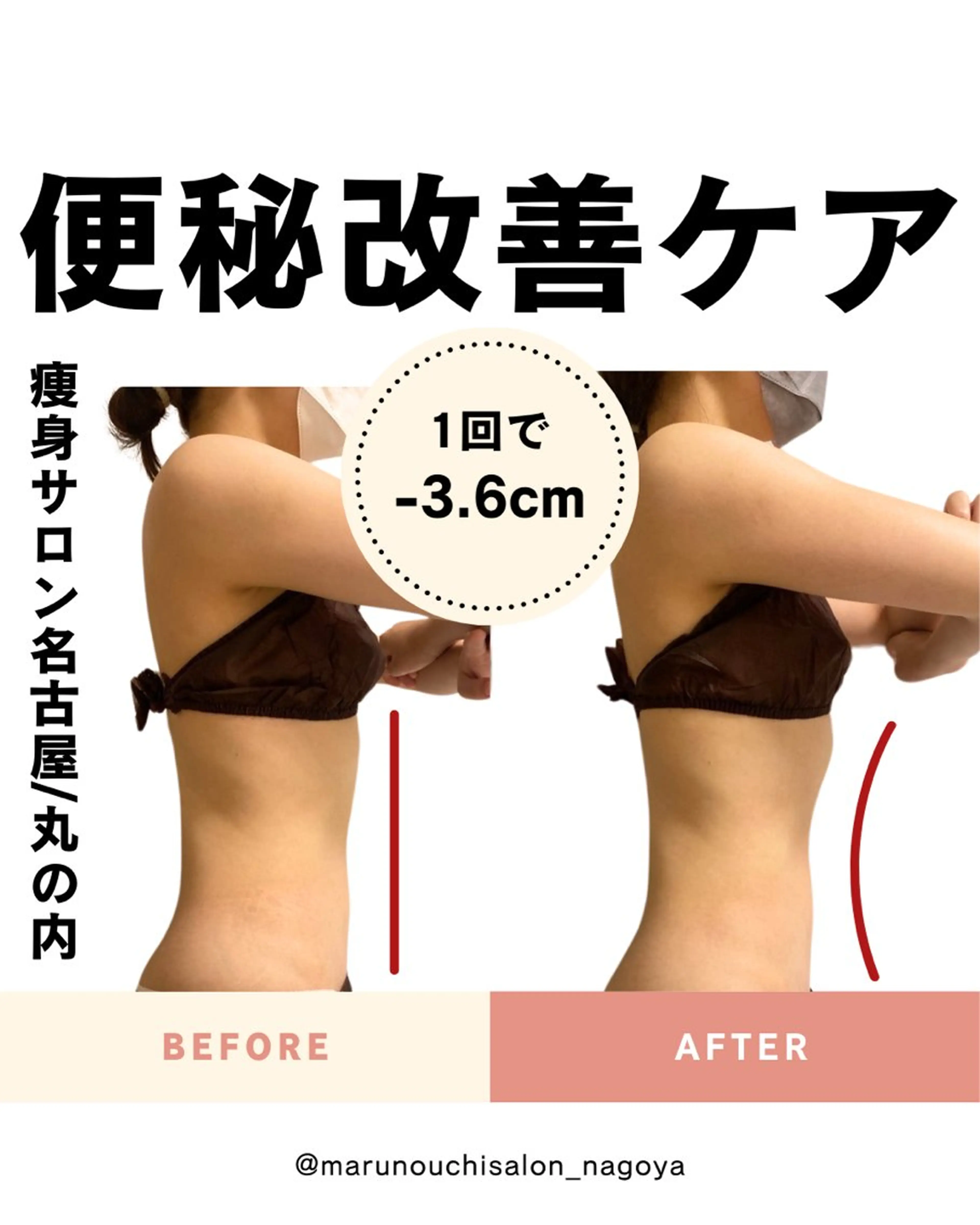 ハイパーナイフ+ハイパーシェイプ 11,000円→3,500円の写真