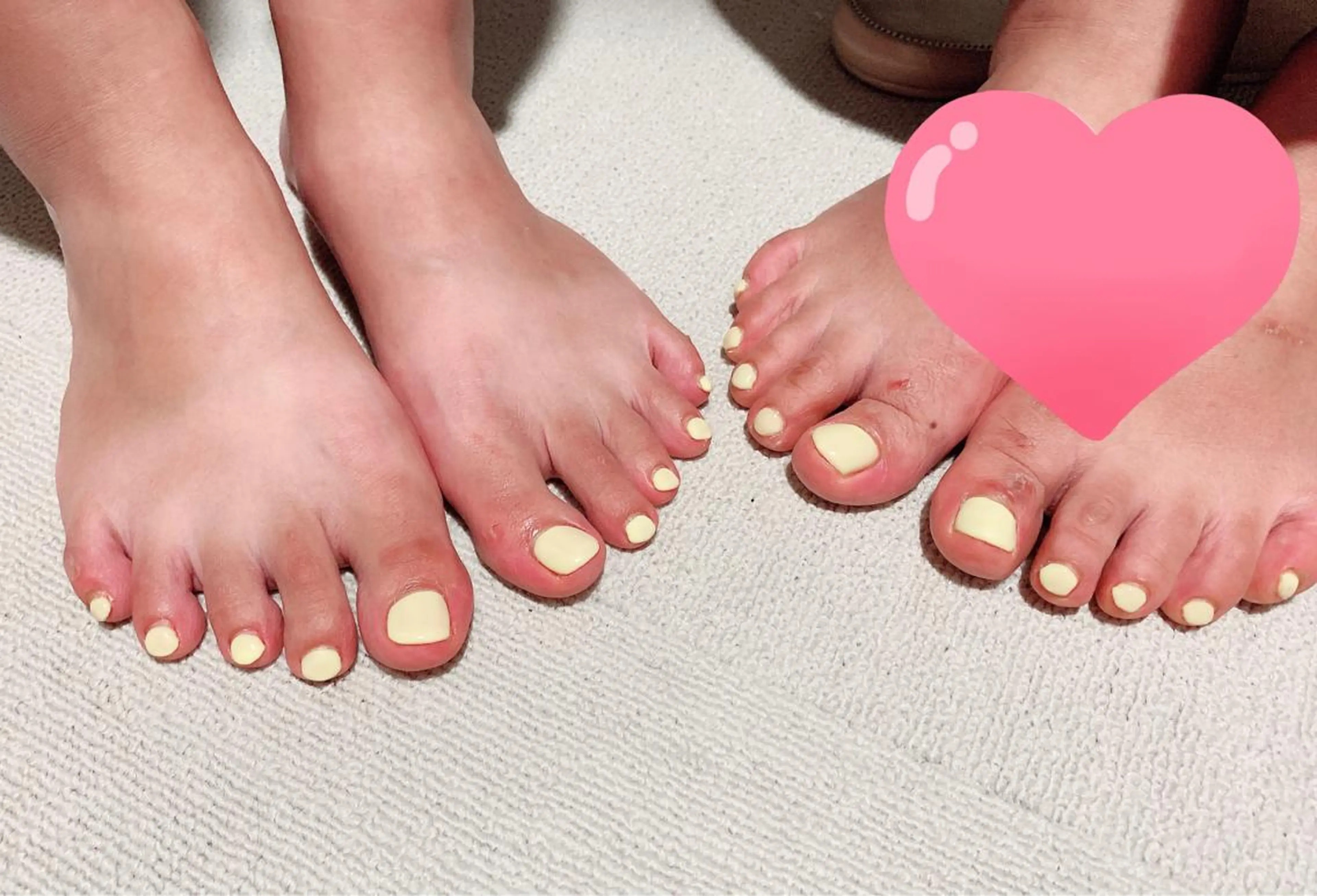 フットワンカラー 4500 （フットバス付き）の写真