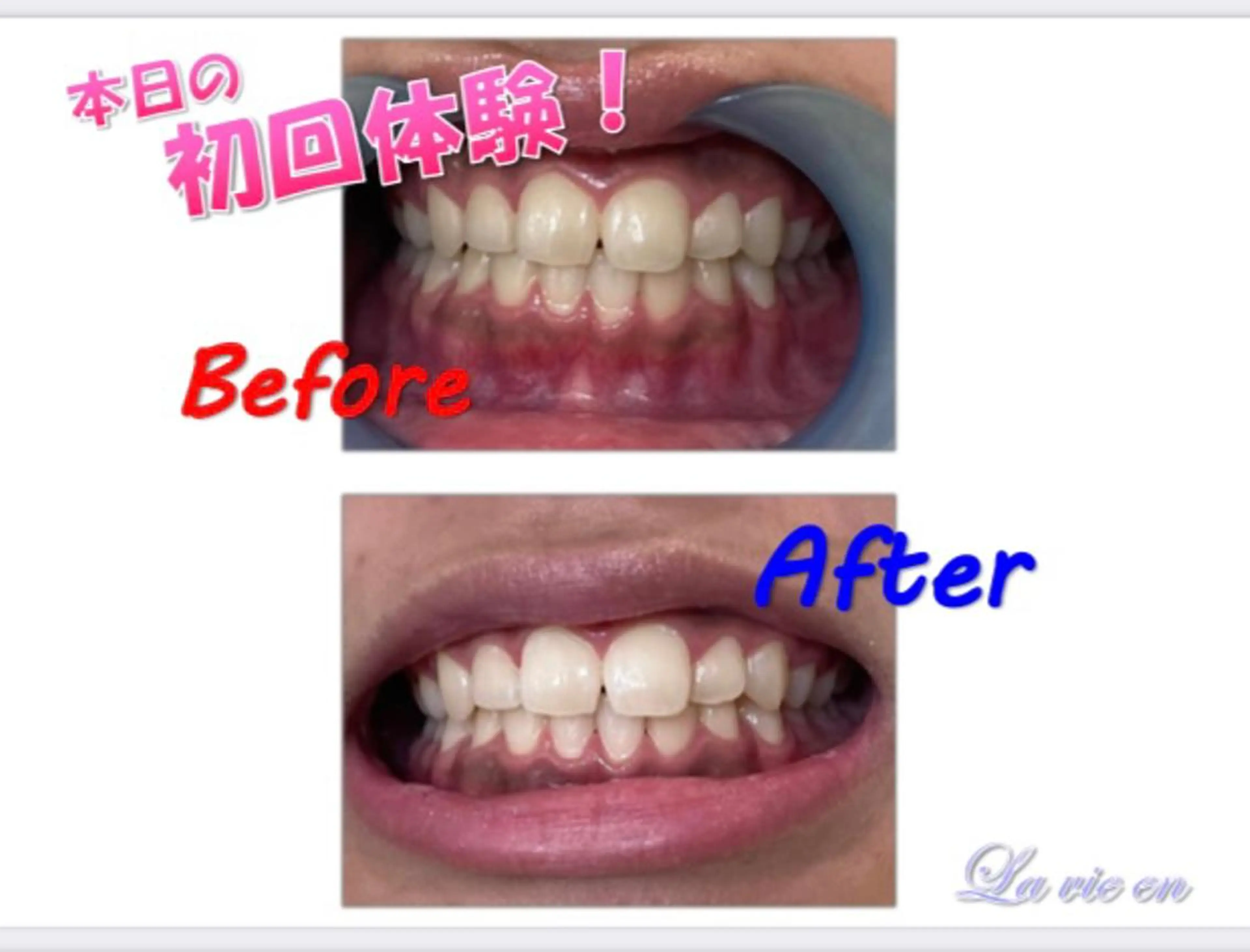 その他 セルフホワイトニングサロン　ラヴィアン所属・ホワイトニングサロン La vie enのその他イメージ