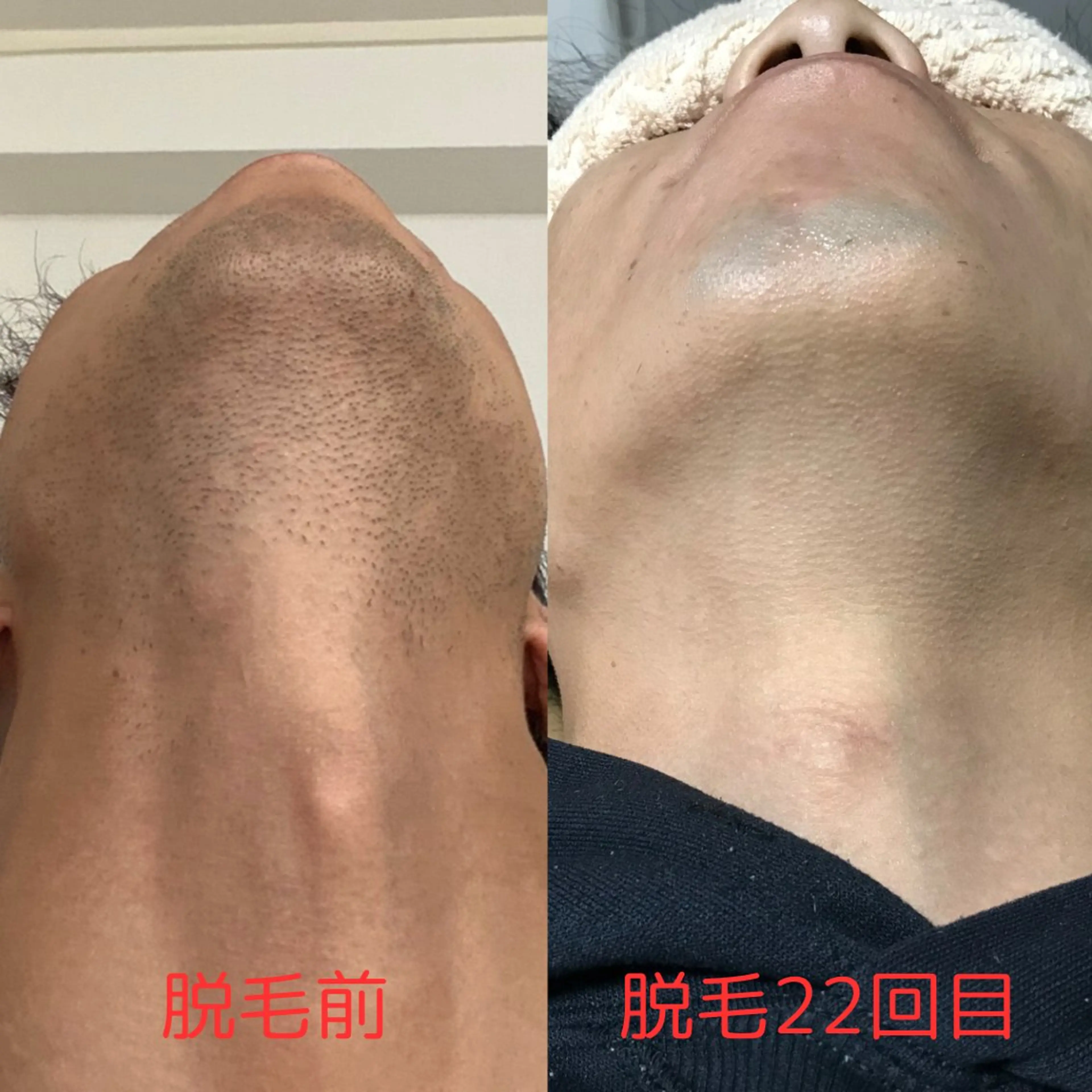 メンズ 脱毛 Beauty K's【ビューティーケイズ】所属・メンズ脱毛サロン ／金山昌弘のエステ・リラクイメージ