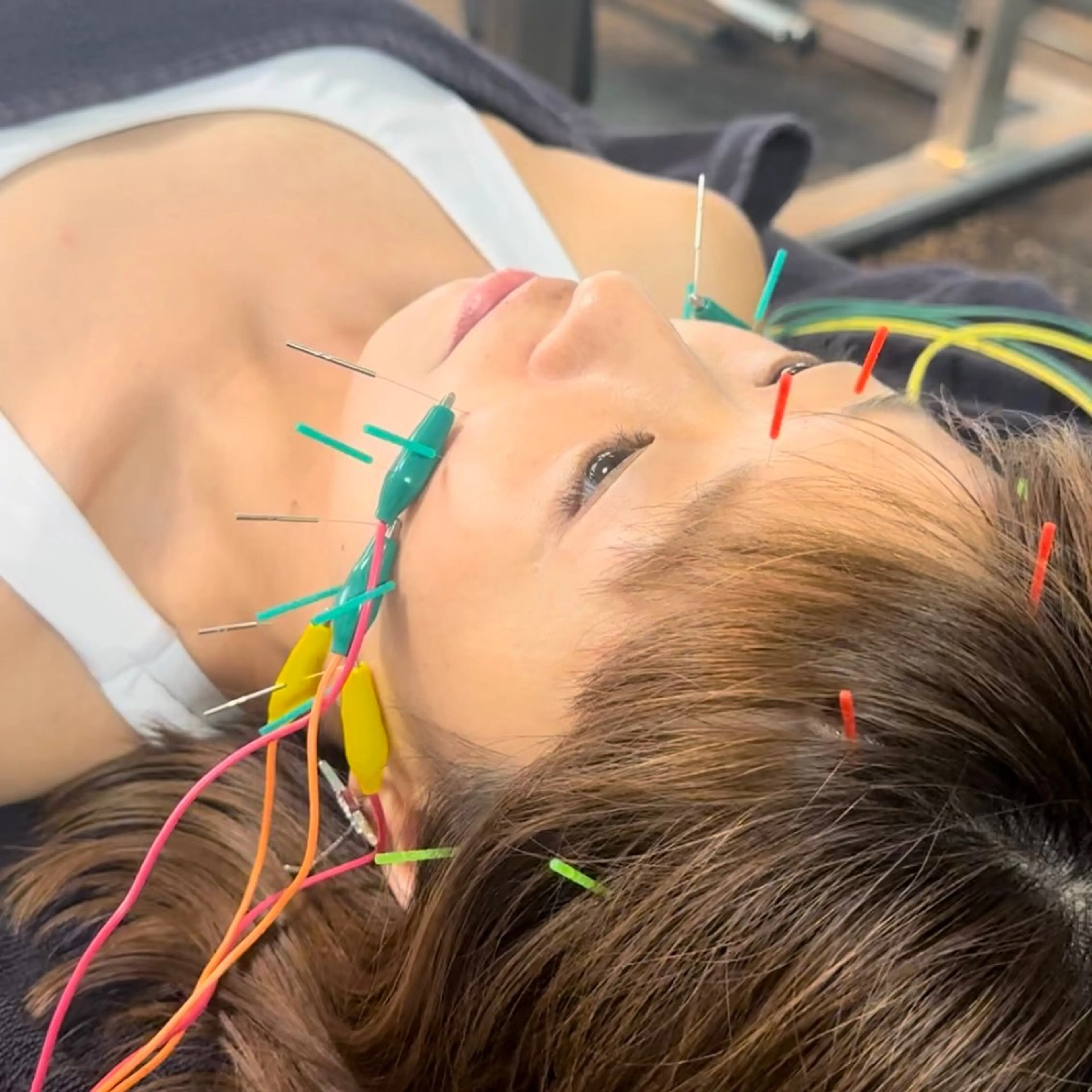 エステ リラク 小顔矯正・美容鍼 FLOW鍼灸整体院のエステ・リラクイメージ