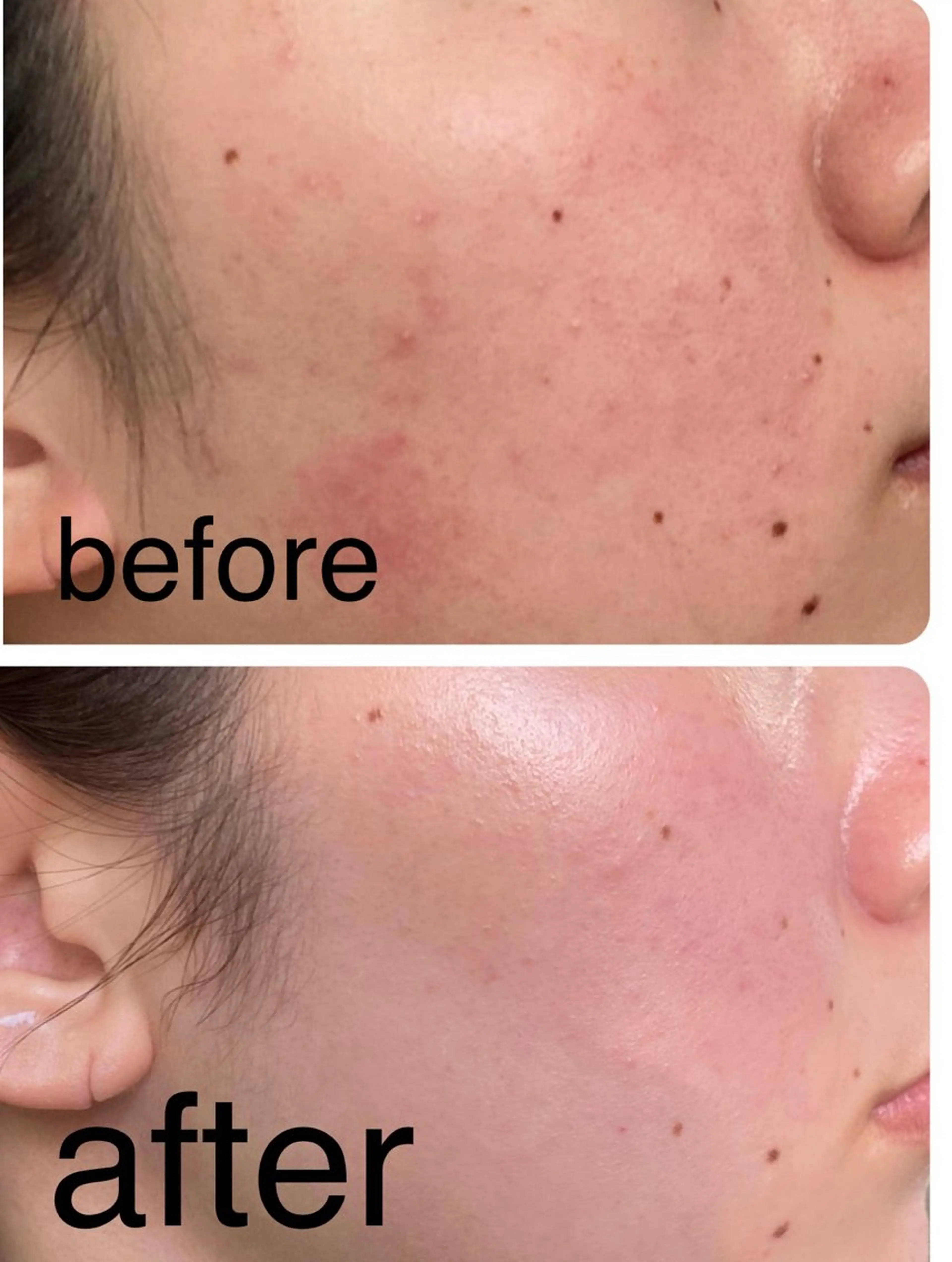 エステ SOYOU所属・岡崎🦋SOYOU 韓国肌管理のエステ・リラクイメージ