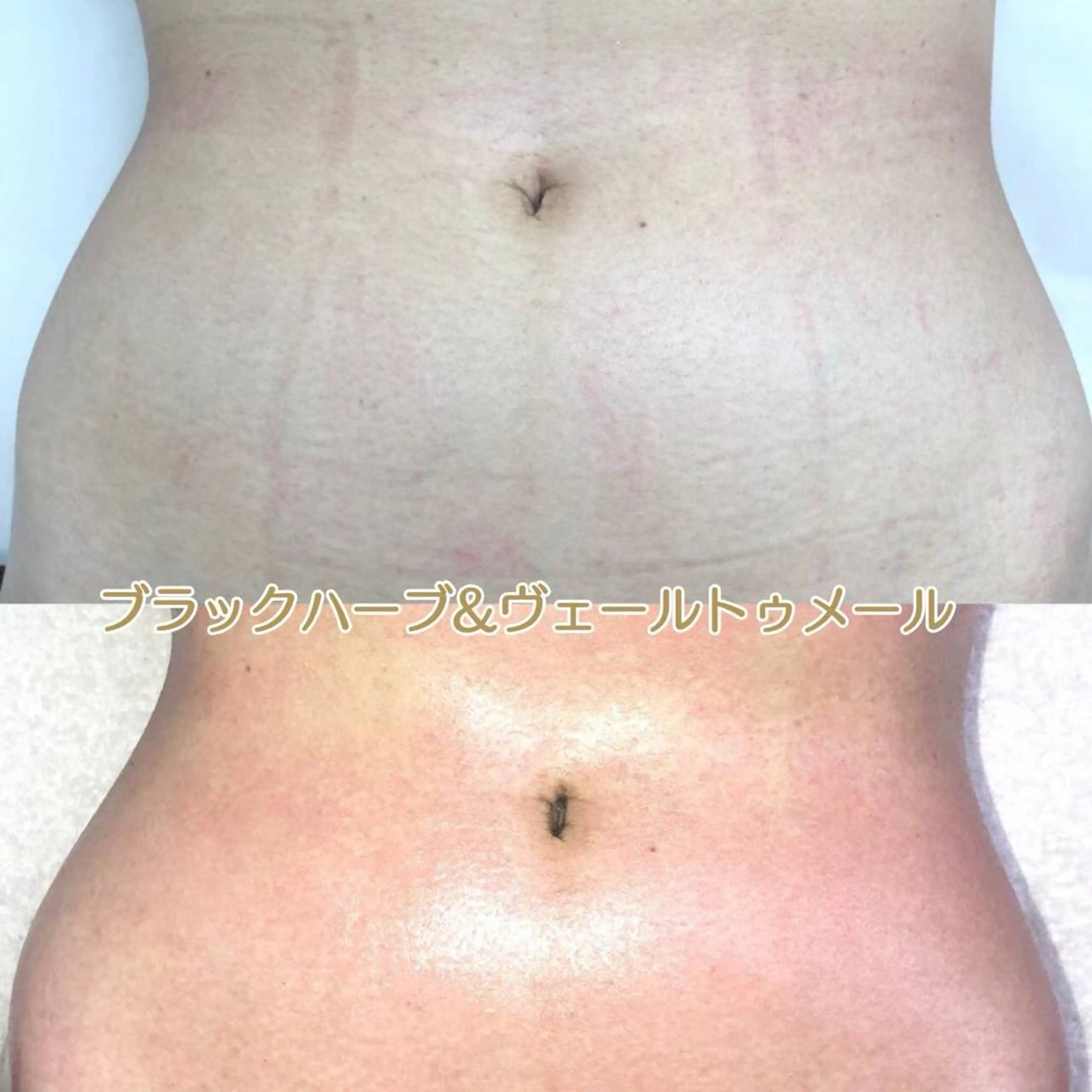 オールハンド フェイシャルのエステ・リラクイメージ