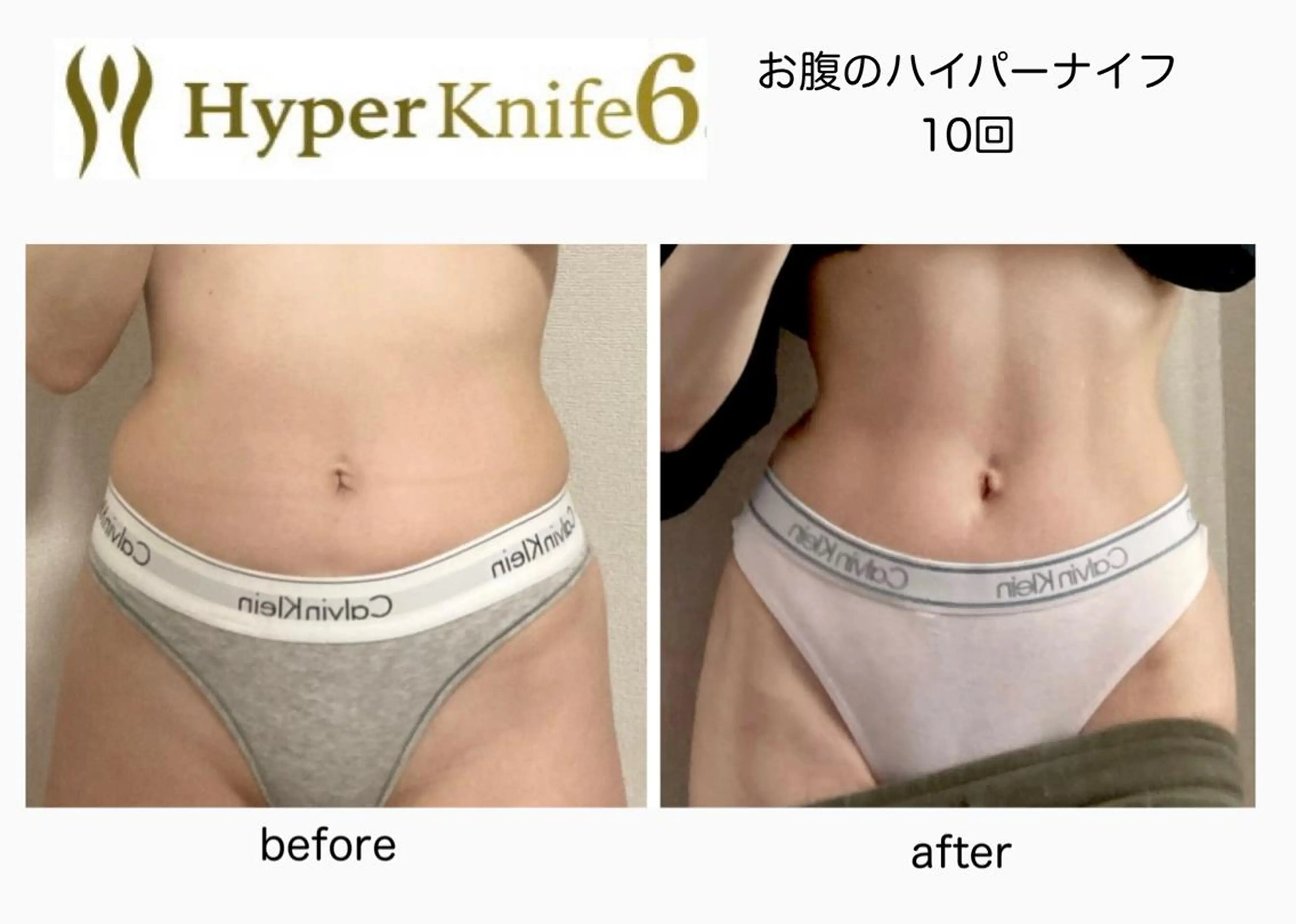 痩身サロンiBDY所属・いわきり ゆきのエステ・リラクイメージ