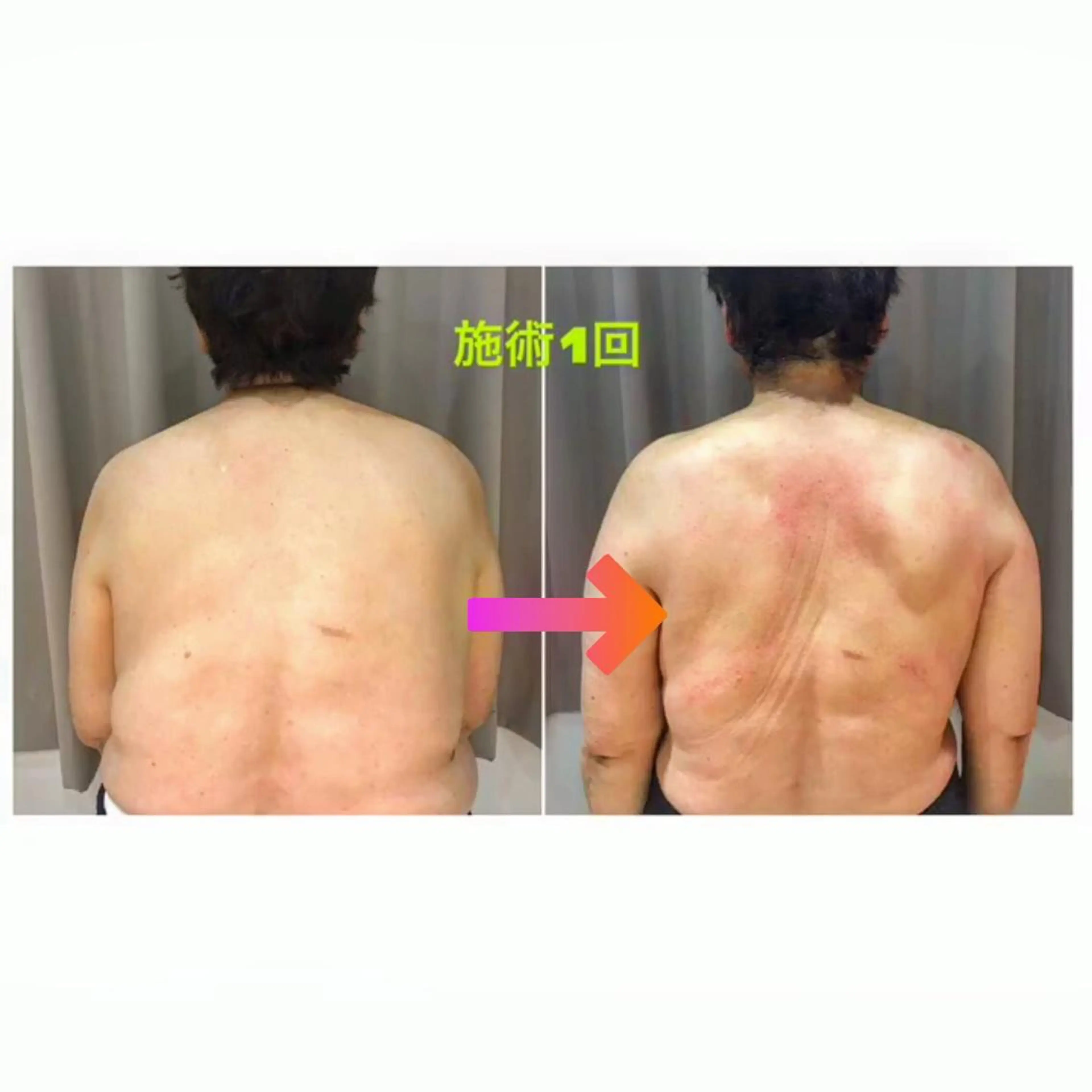 代表 MOMOのエステ・リラクイメージ