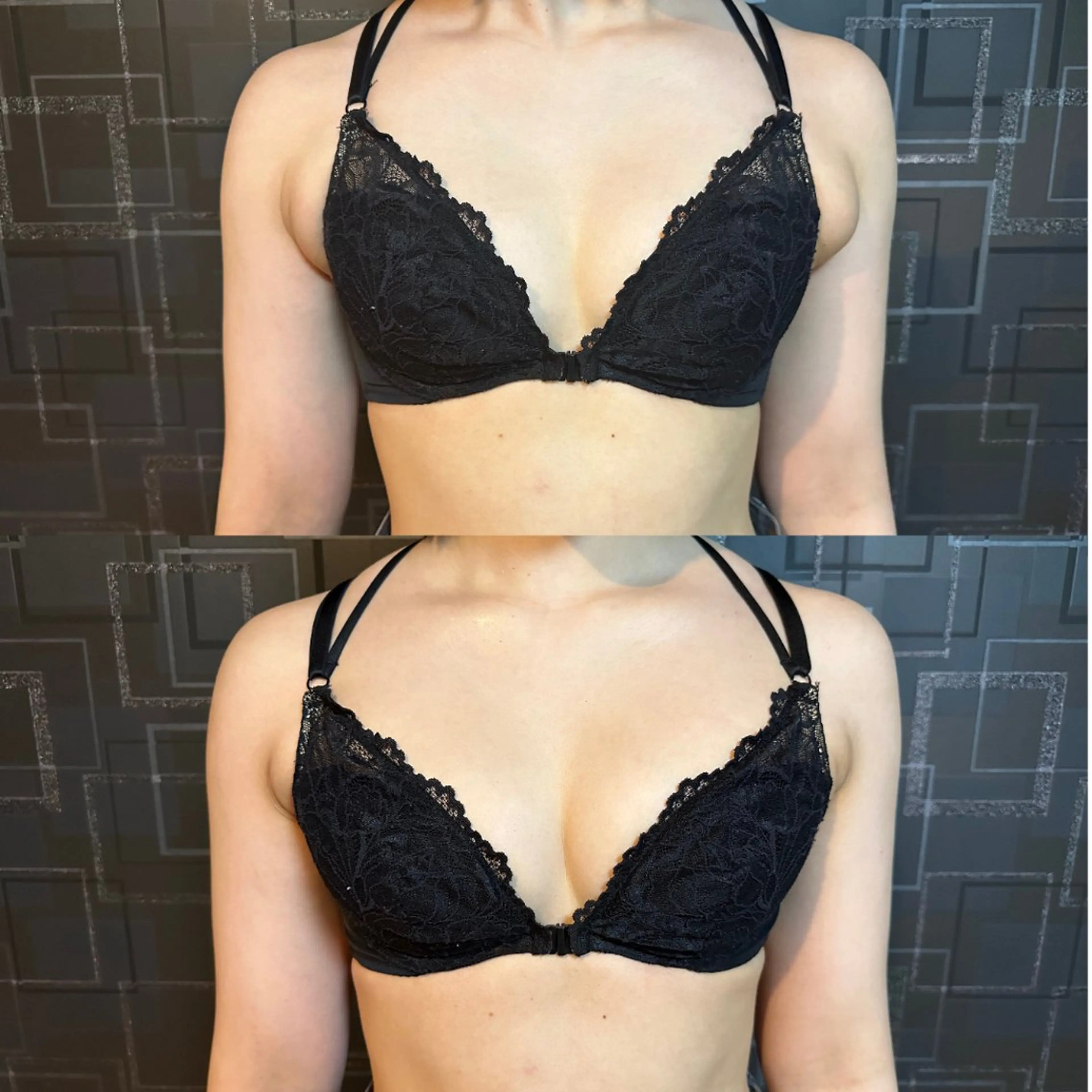 【肩凝り・背中凝り重視】美乳を創るバストケア施術（上半身）の写真