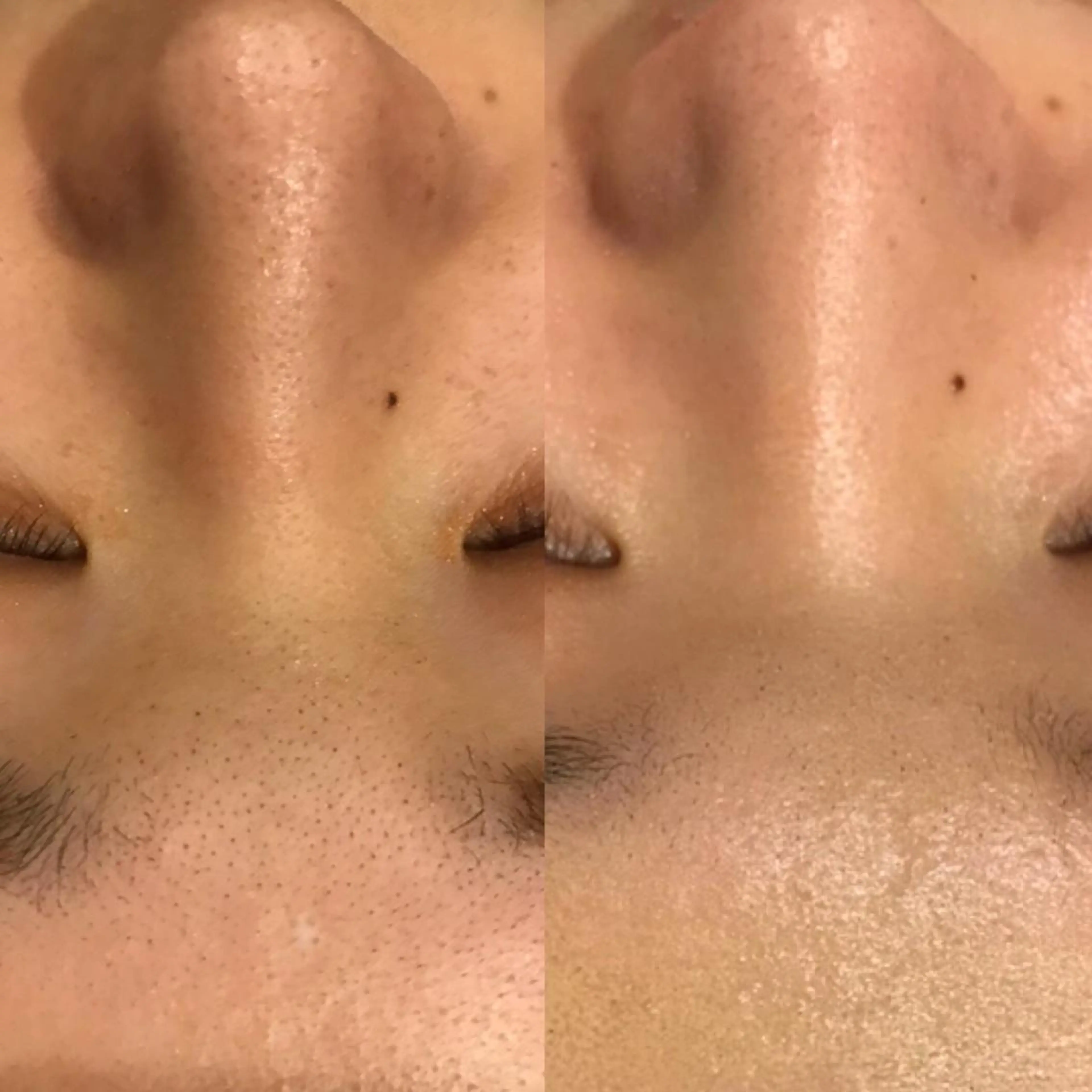 エステ 美肌脱毛専門サロン Dione栄店のエステ・リラクイメージ