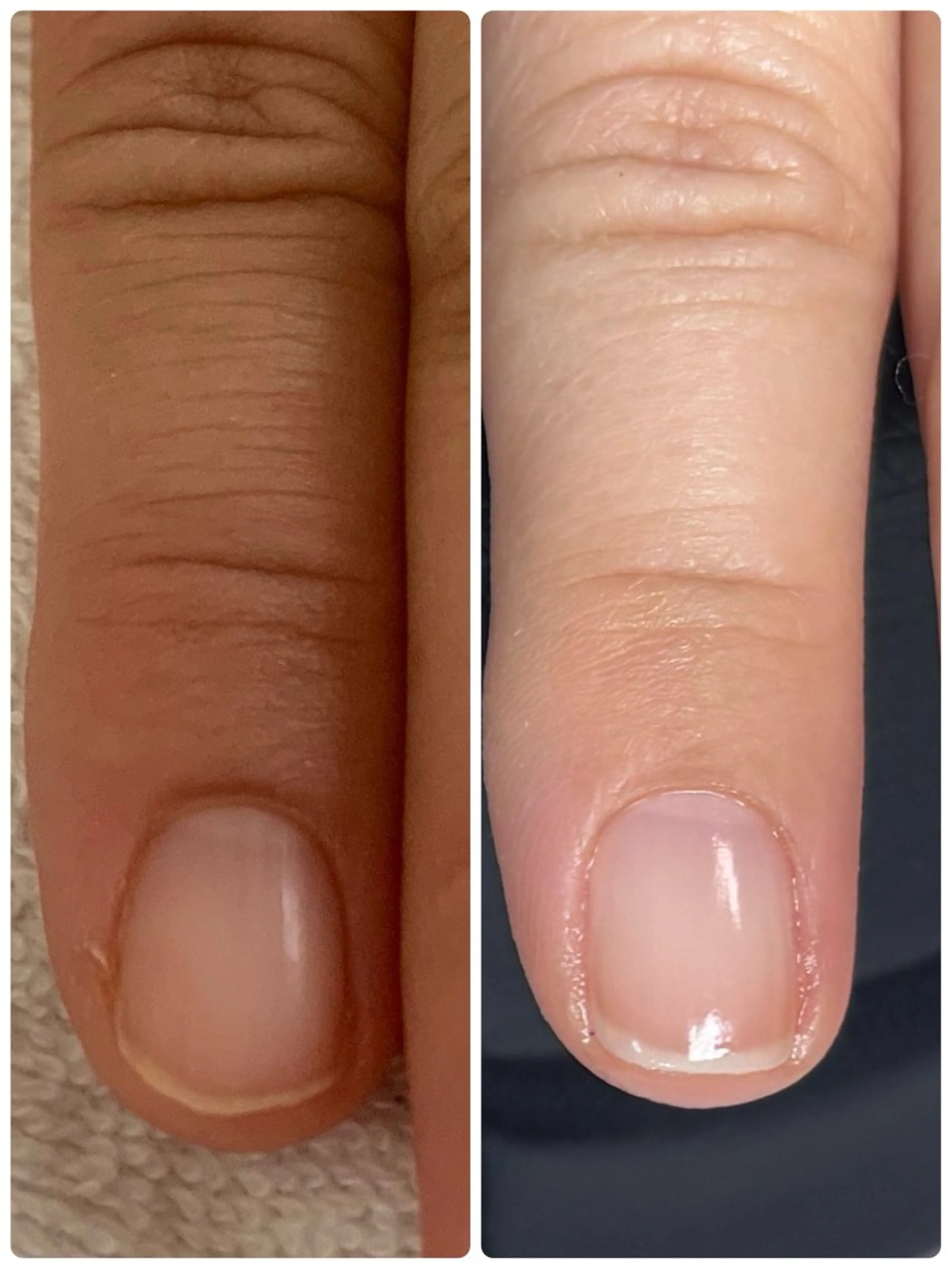ネイル Alo.nail アロ•ネイルのネイルデザイン