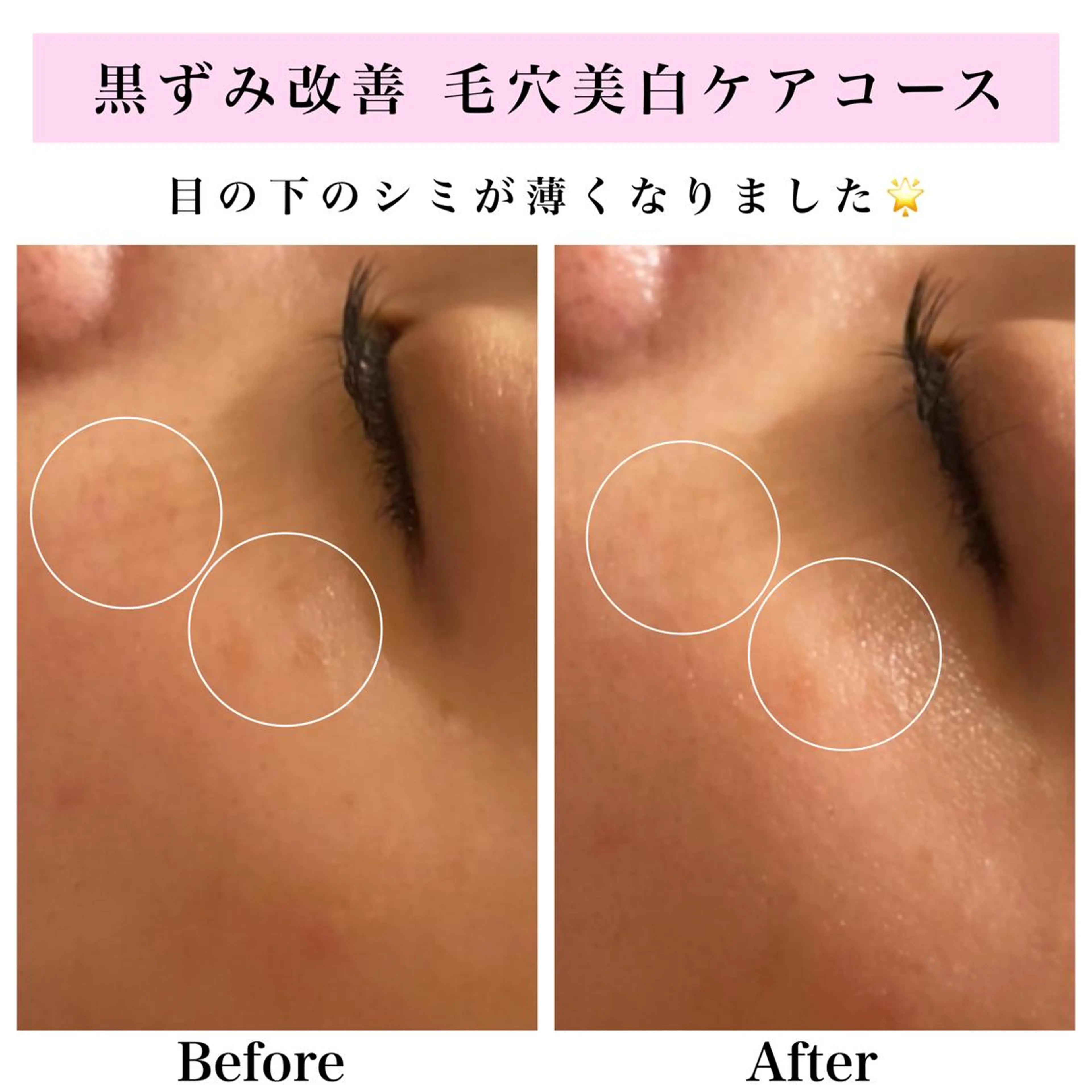 エステ リラク Bellesthe （ベルエステ）のエステ・リラクイメージ