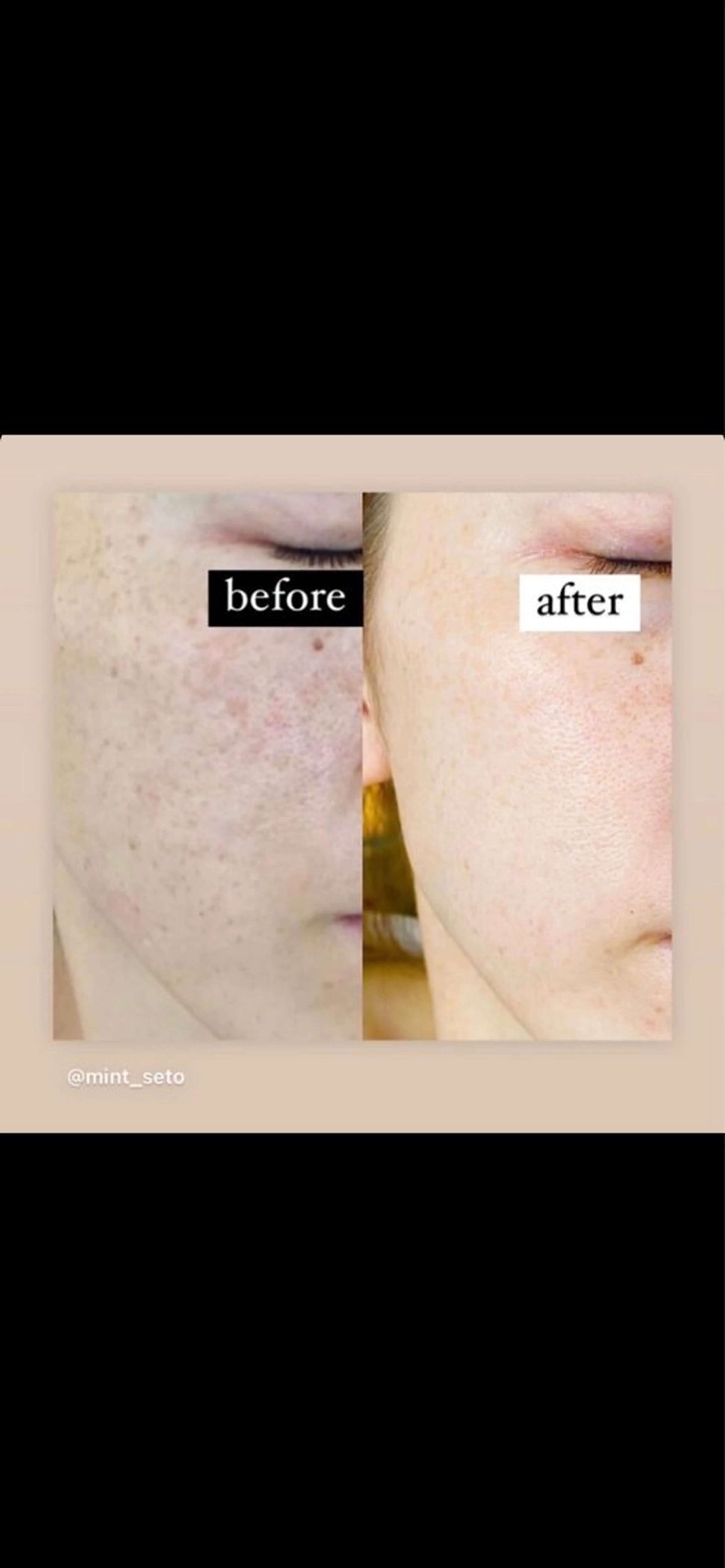 プライベートサロンmint所属・佐藤 綾香のエステ・リラクイメージ