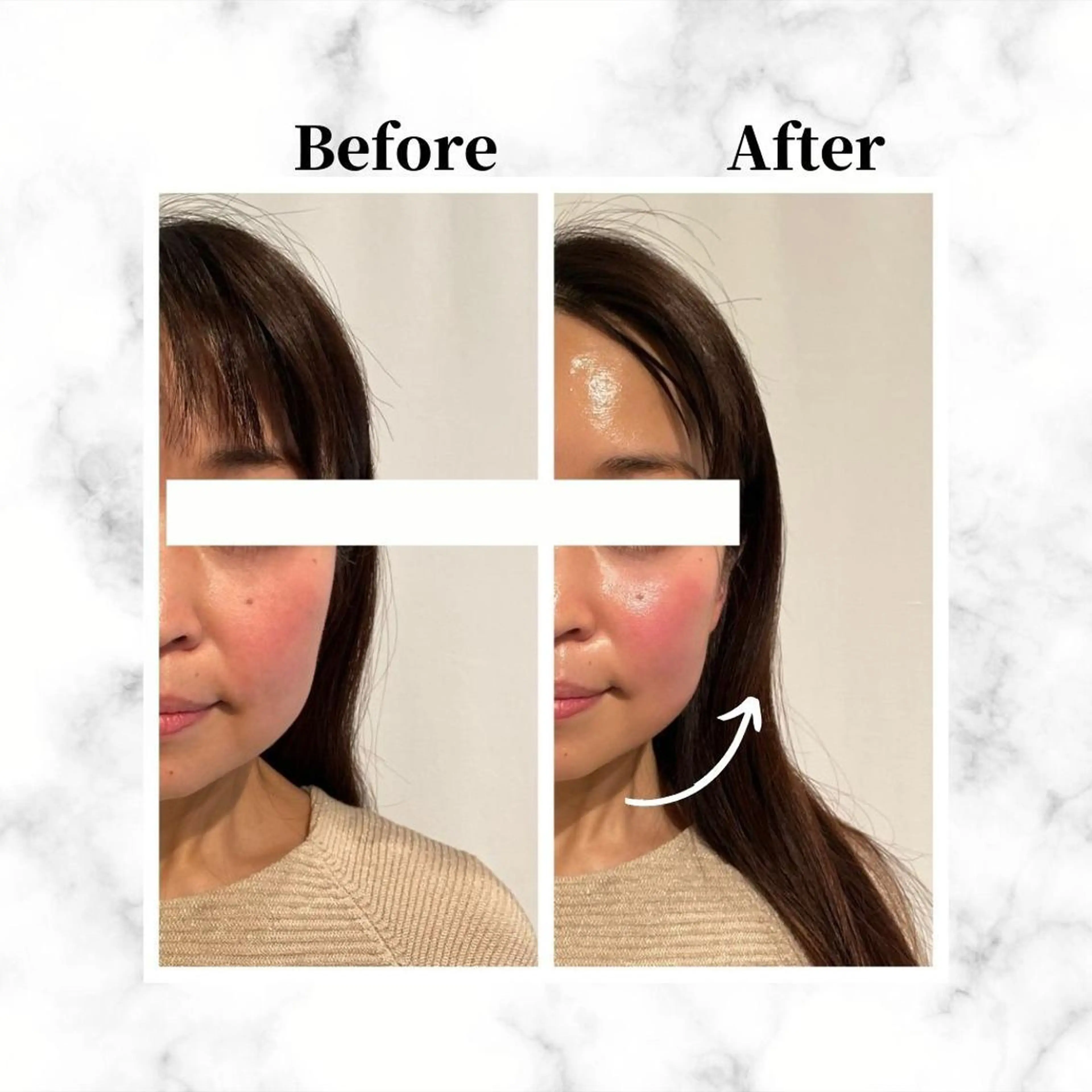 エステ リラク 12Dハイフ💗 最強小顔のエステ・リラクイメージ