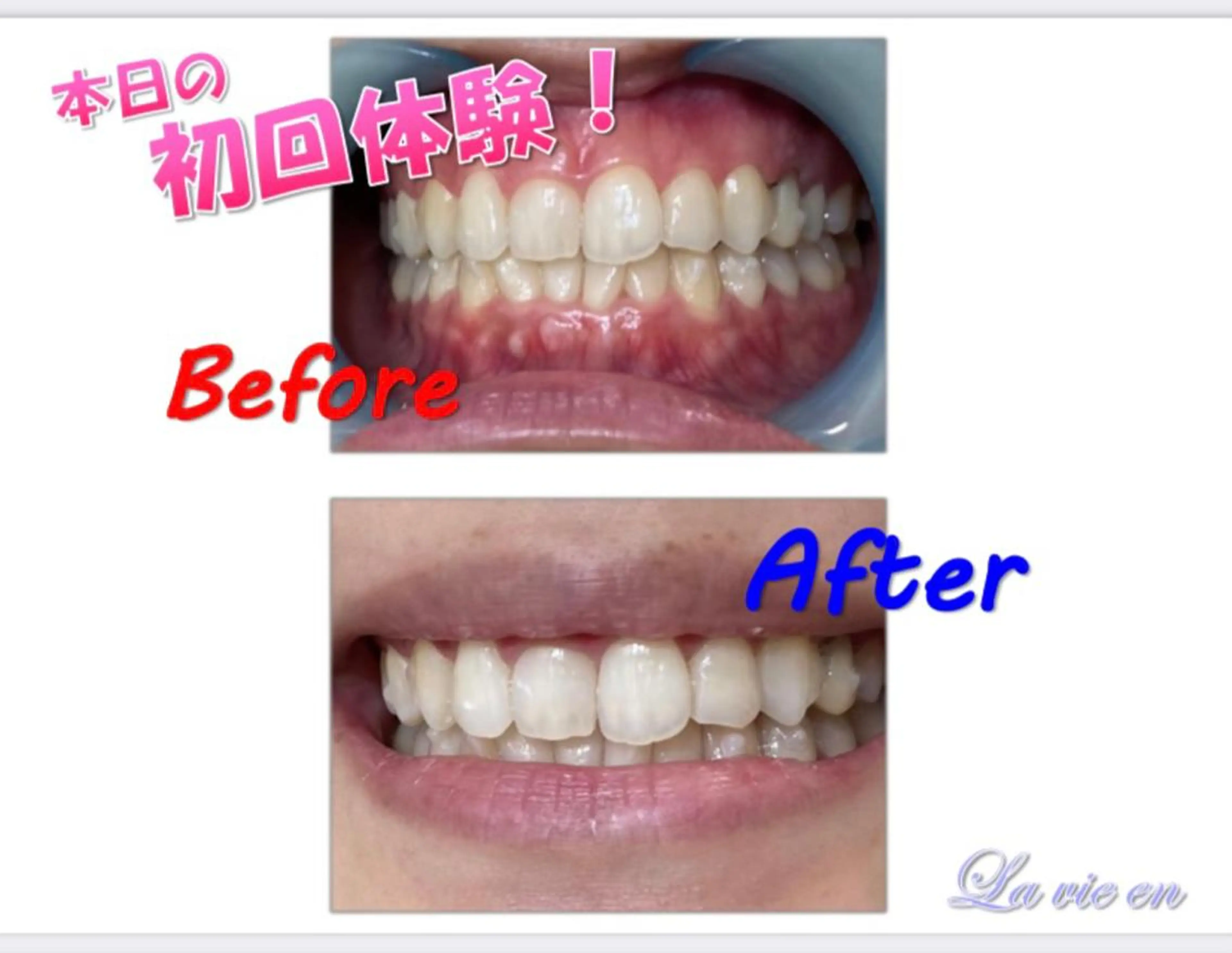 その他 セルフホワイトニングサロン　ラヴィアン所属・ホワイトニングサロン La vie enのその他イメージ