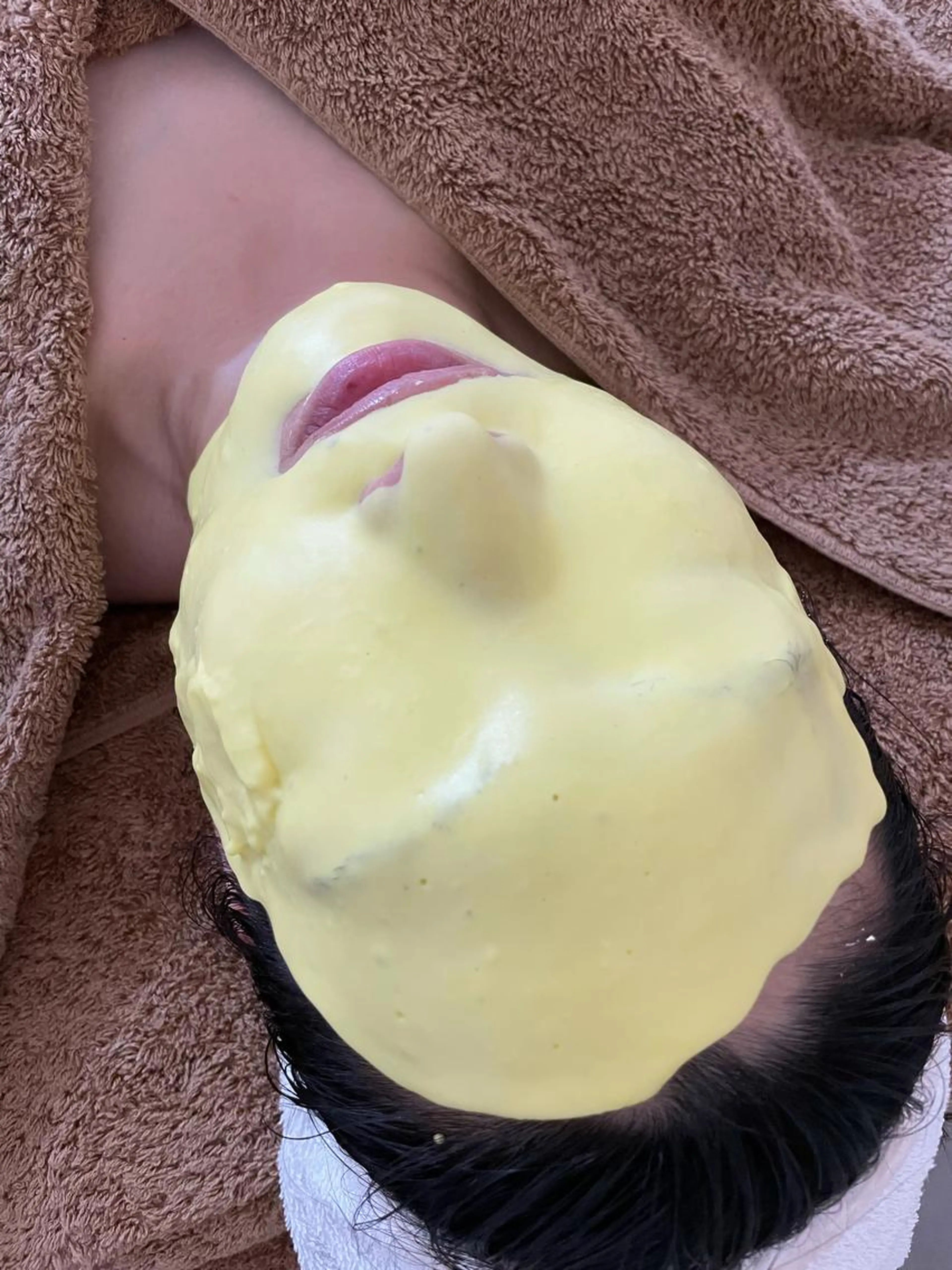 疲れ肌に黄色のビタミン!夏肌を支える土台作り✨/ダブルビタQパック付きエステ/なかなか治らない肌荒れ・ニキビ/の写真