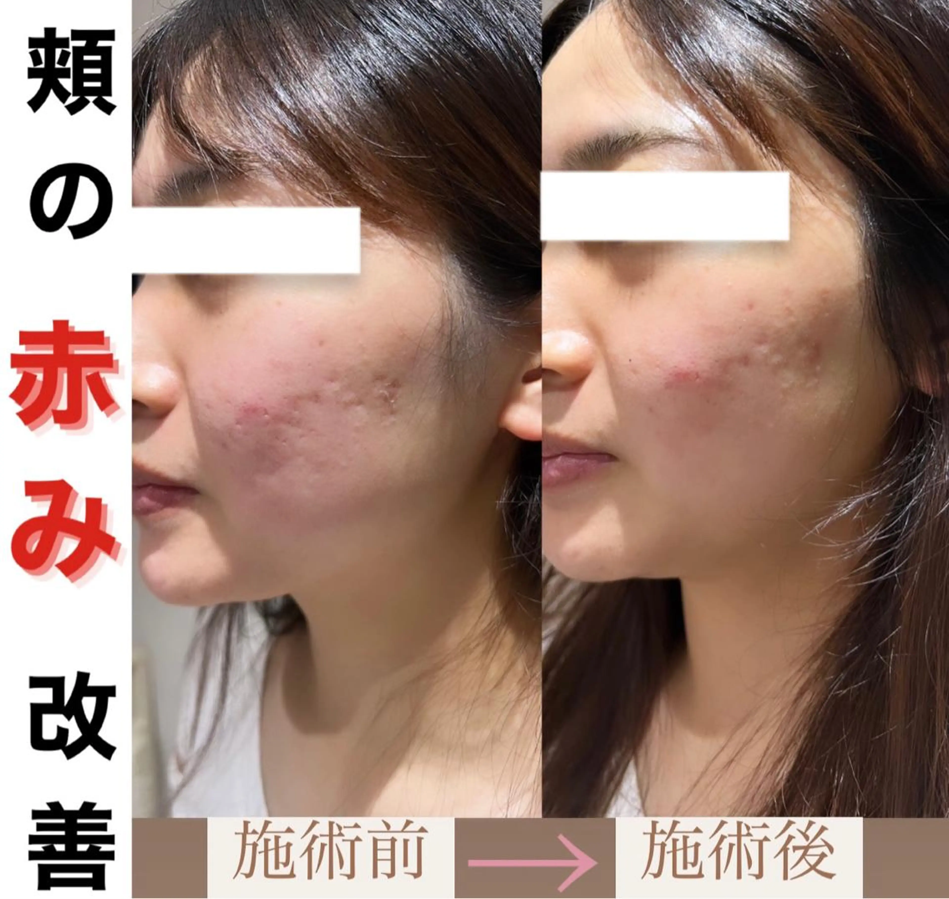 脱毛&美容サロンBLUESEA所属・脱毛&美容サロン BLUESEAのエステ・リラクイメージ