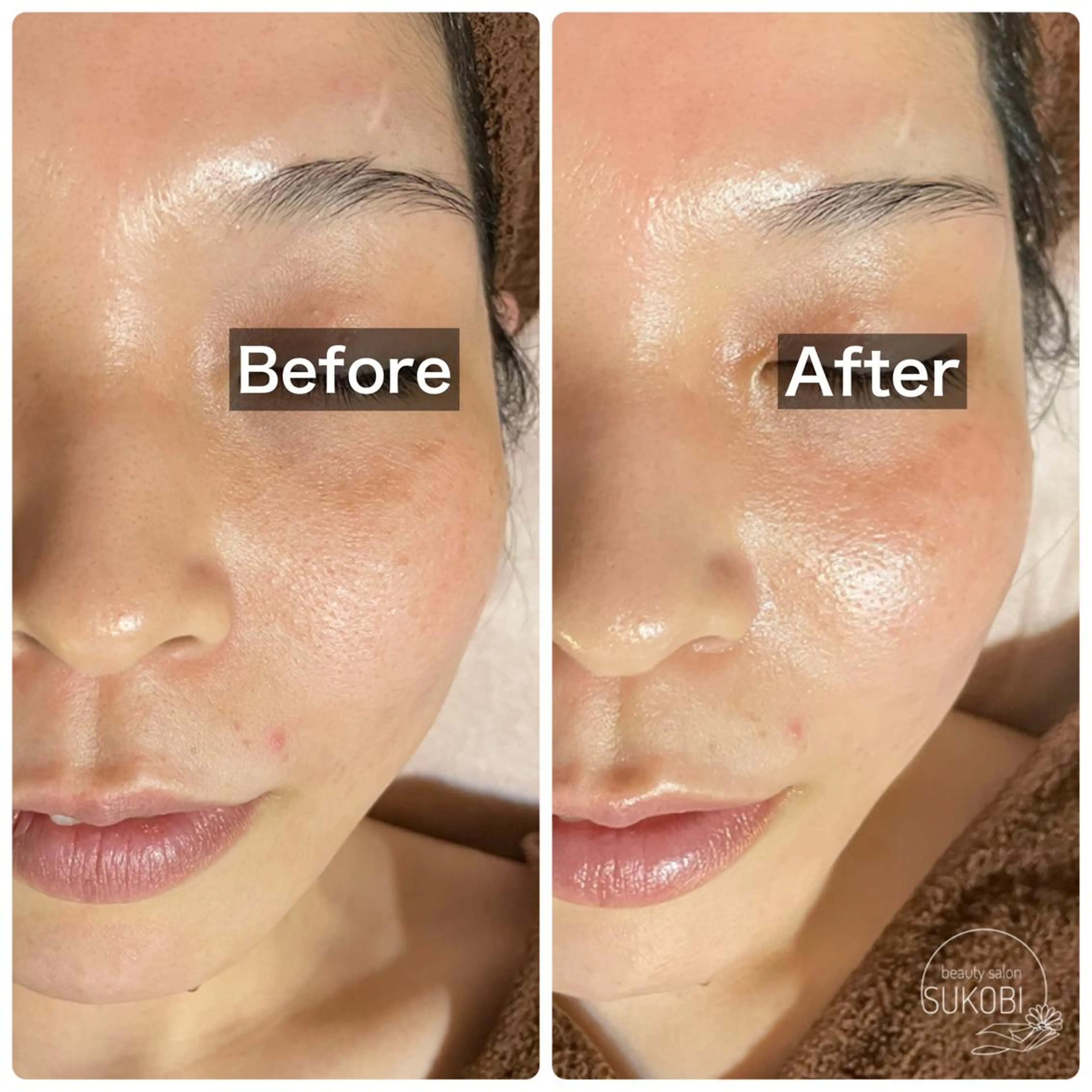 夏専用シーズナルエステ(デコルテ＋フェイシャルのオールハンド)小顔＋透明感＋美白！！(90分)の写真