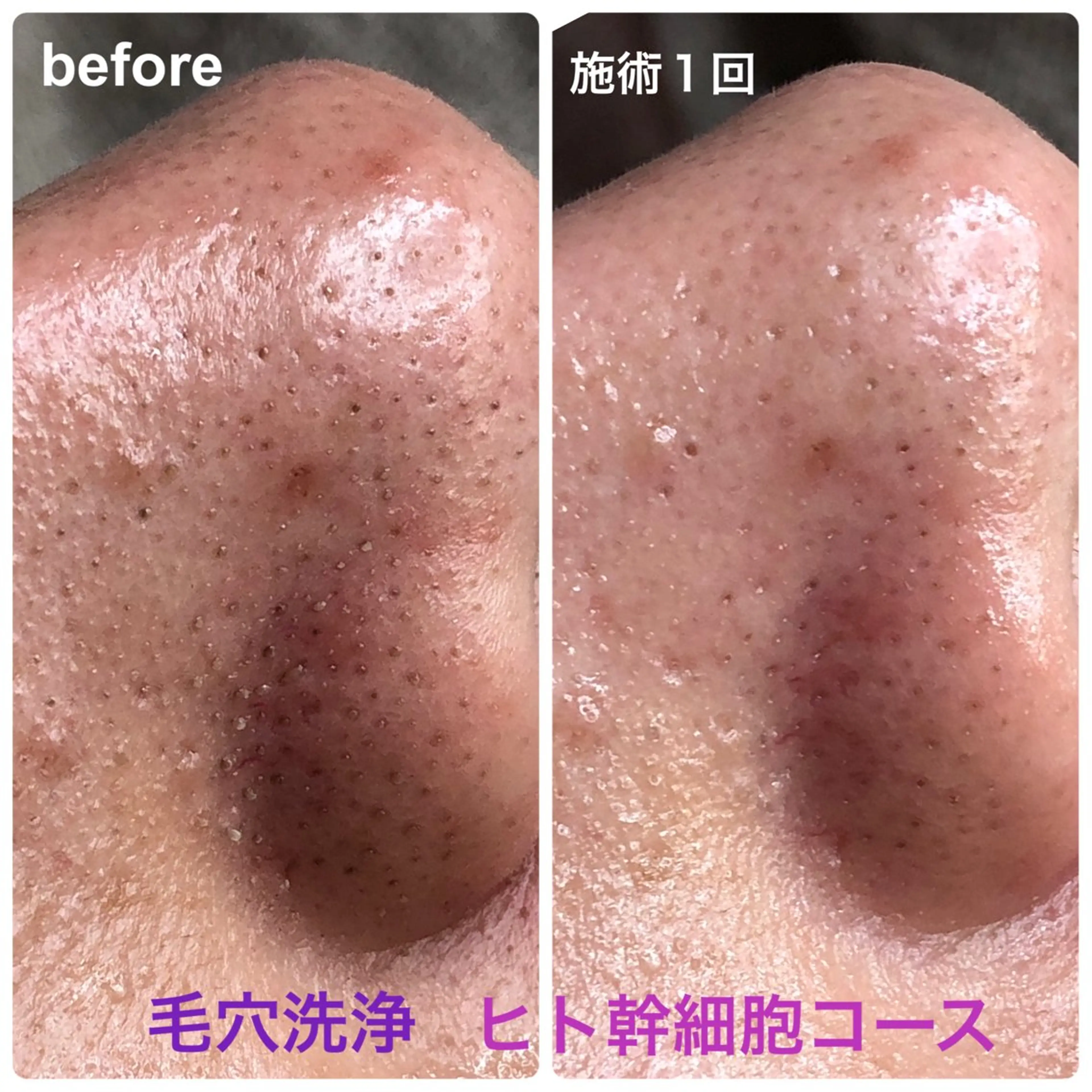 メンズ エステ beauty salon Primus所属・Primus ﾌﾟﾘﾑｽのマツエク・マツパデザイン