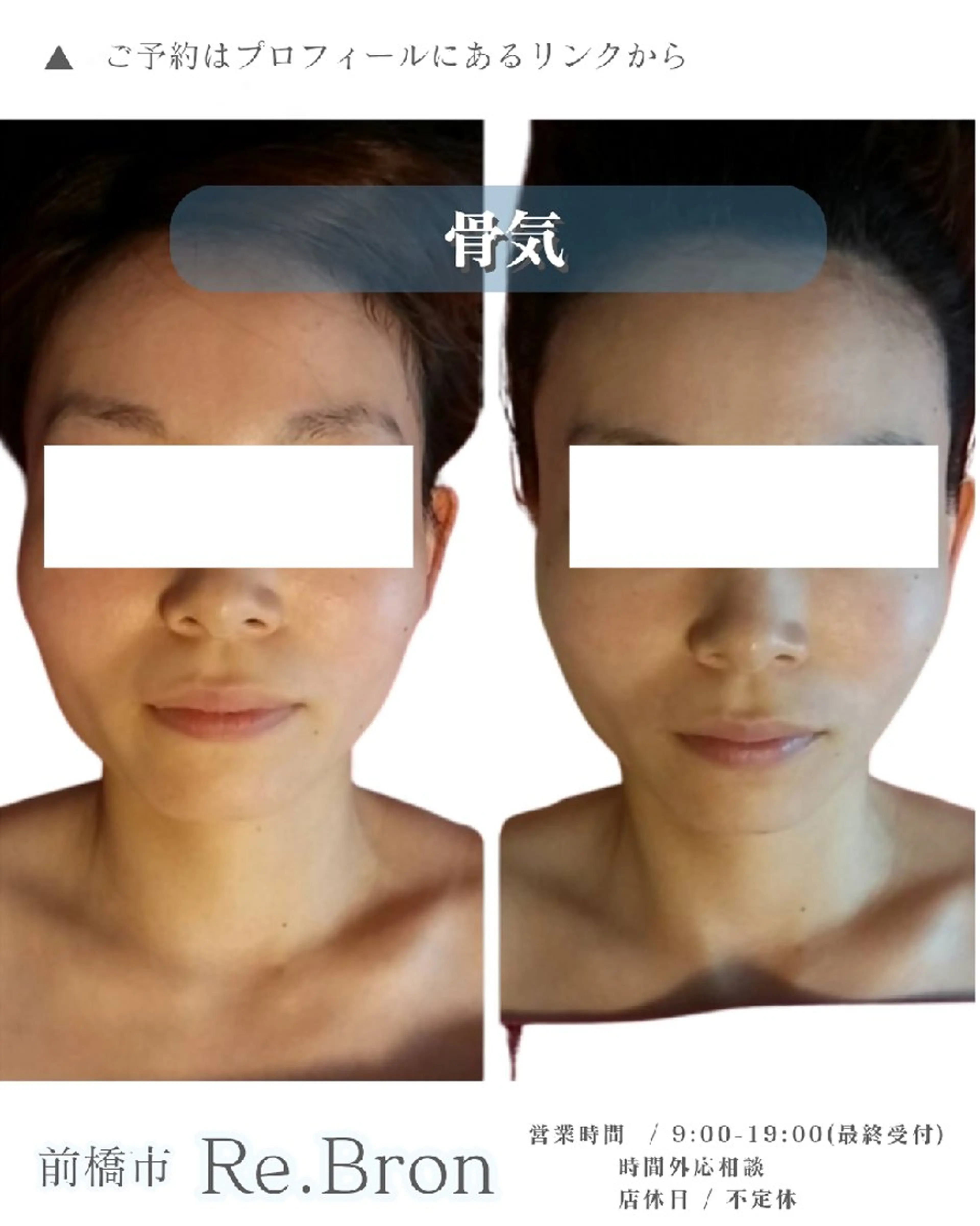 エステ リラク 毛穴ケア くすみ肌 ハーブピーリングのエステ・リラクイメージ