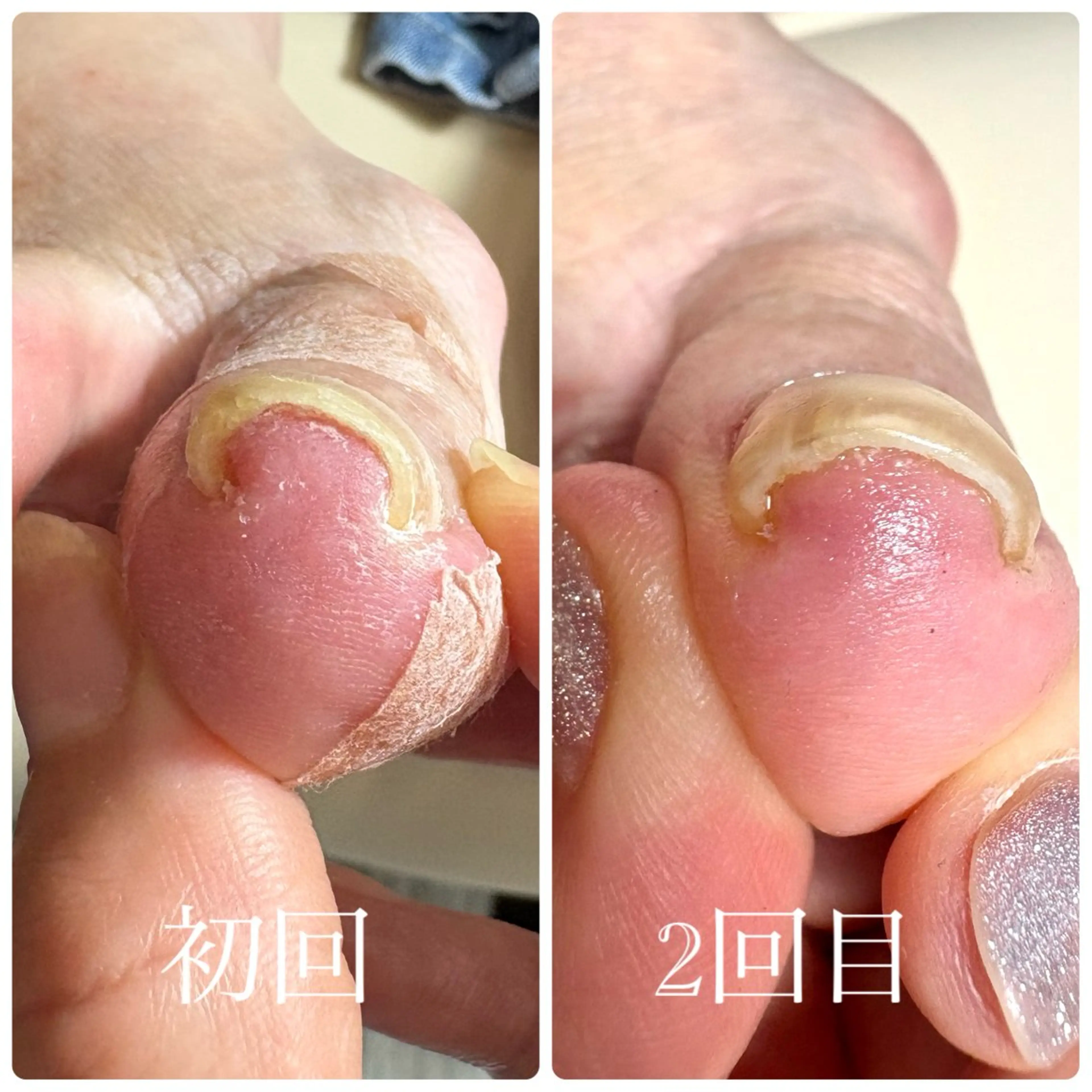 荒井 恵のネイルデザイン