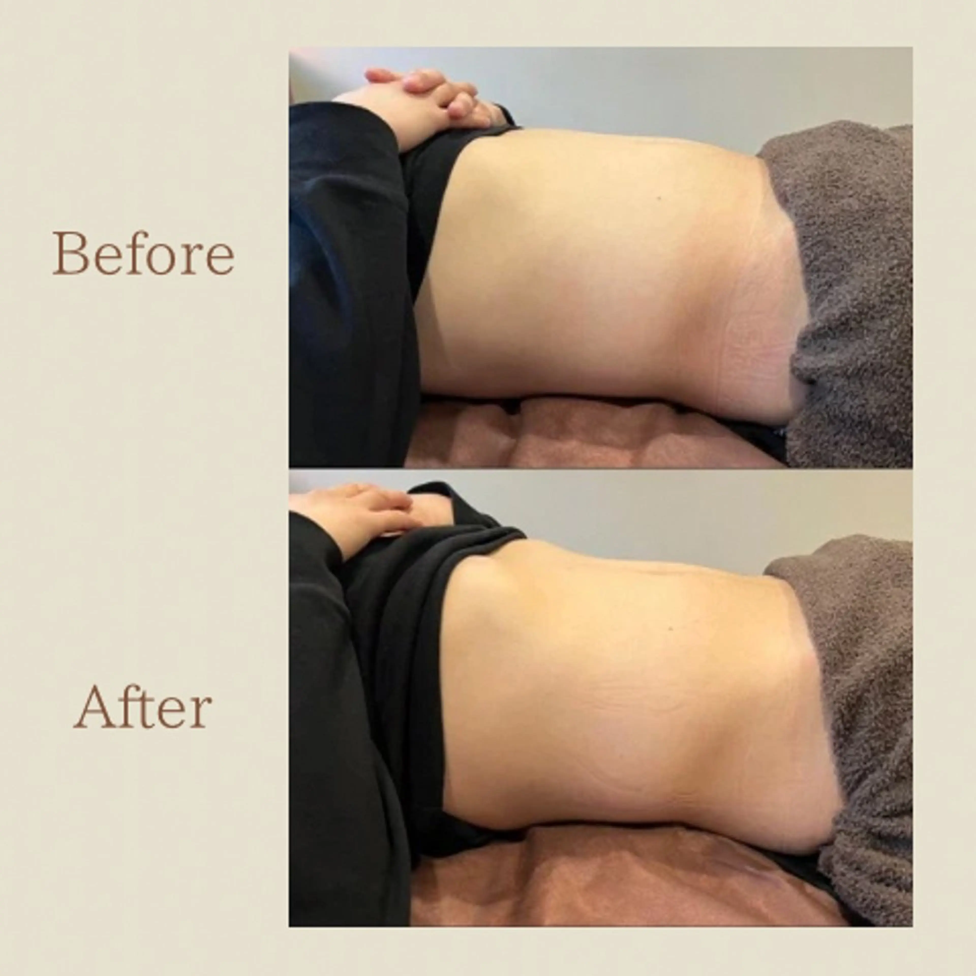 お腹痩せエステ Flat BELLY 恵比寿所属・【腸もみ/冷却痩身】 お腹エステ/恵比寿のエステ・リラクイメージ