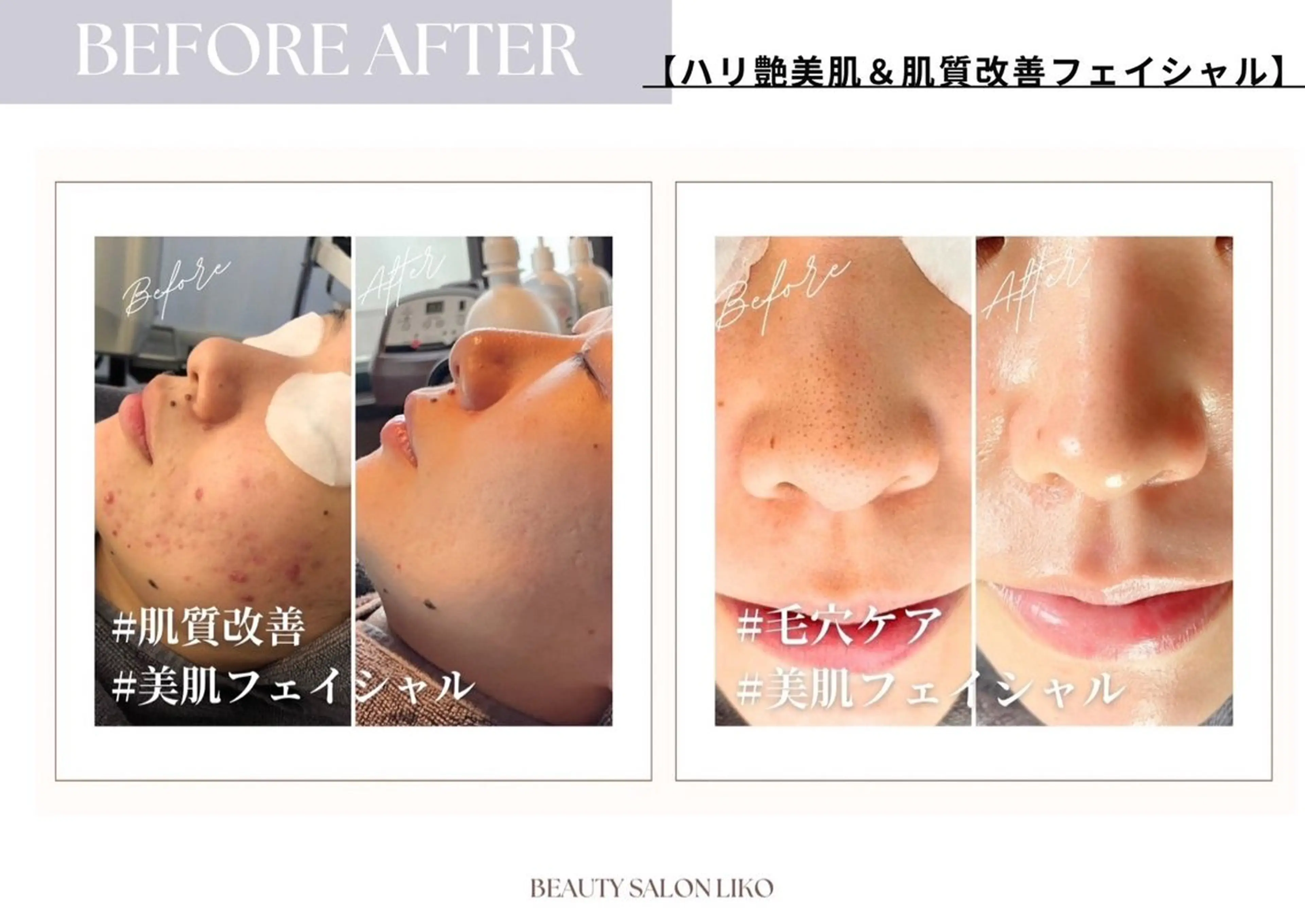 Beauty salon  Liko所属・LIKO フェイシャル&ボディのエステ・リラクイメージ
