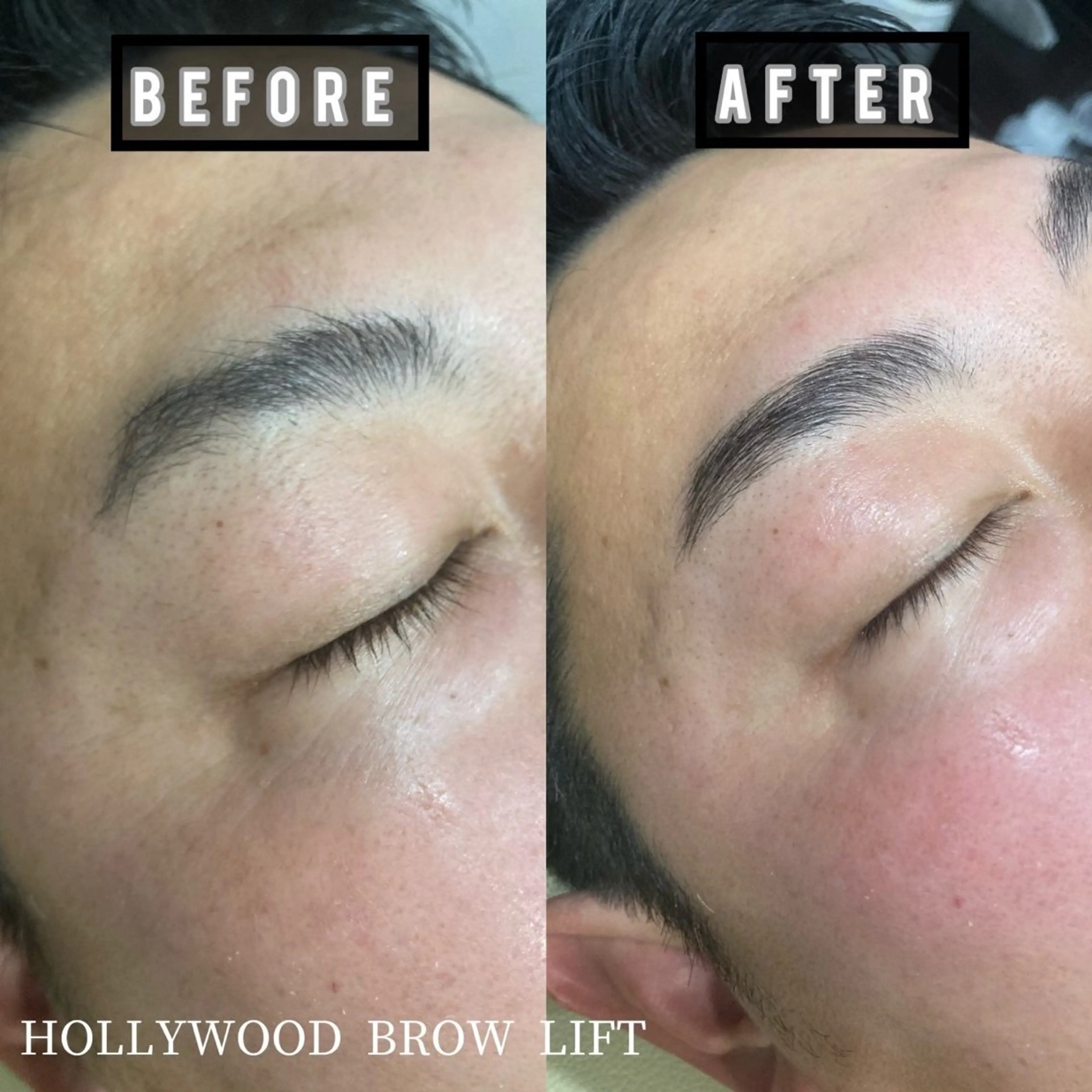 【お試し】ハリウッドブロウリフトの写真