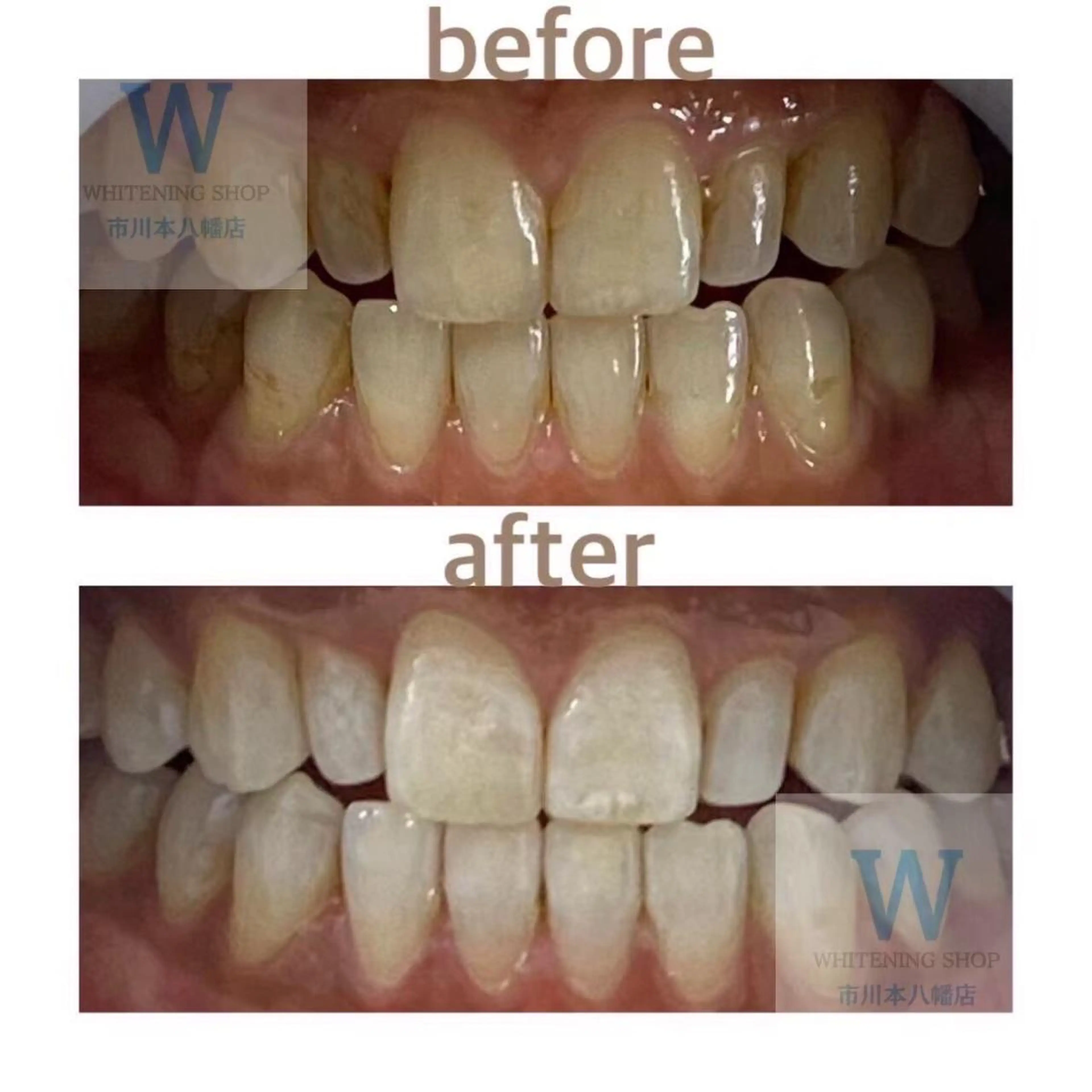 ホワイトニング ショップ本八幡店のエステ・リラクイメージ