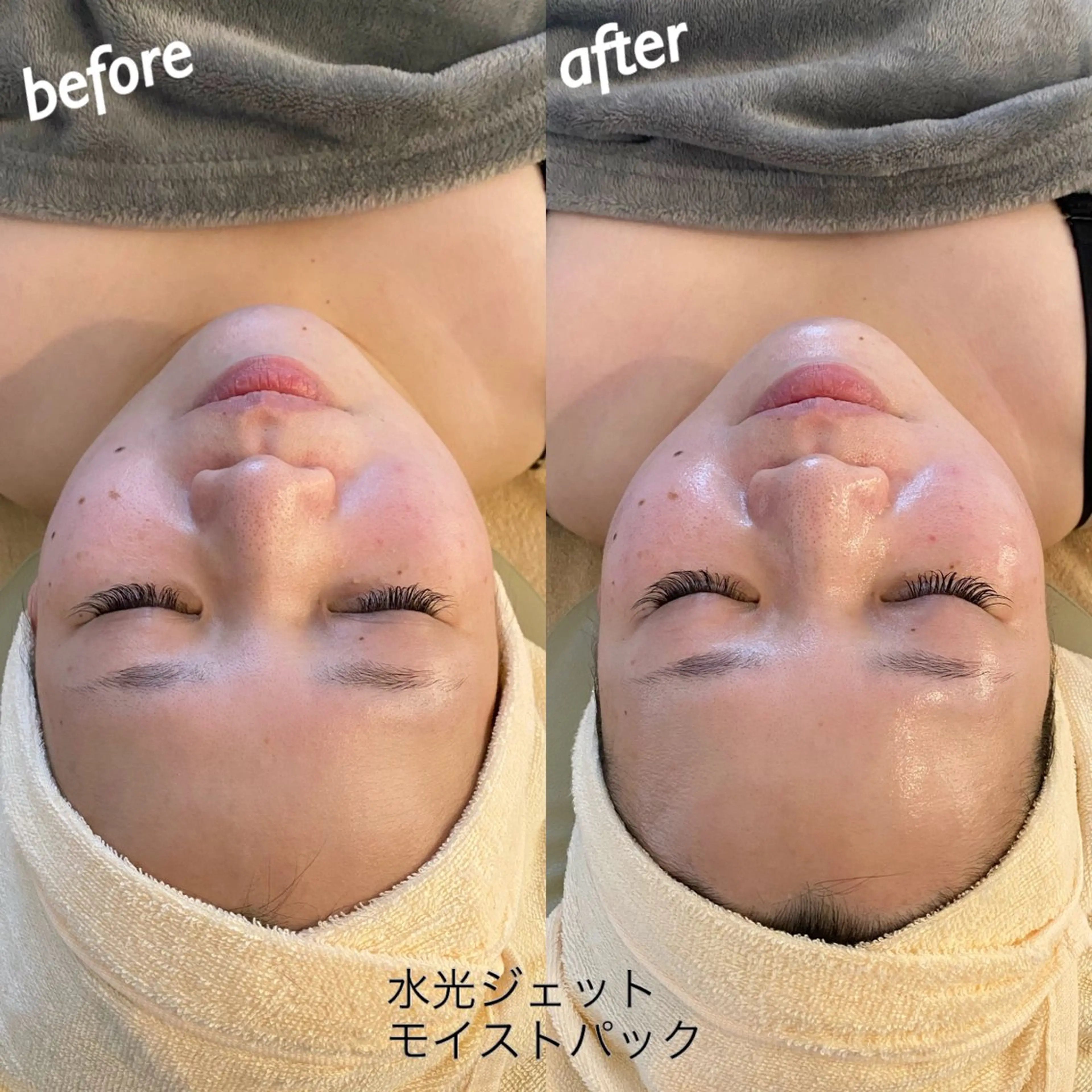 エステ リラク うなじ脱毛/美肌脱毛 LABELのエステ・リラクイメージ