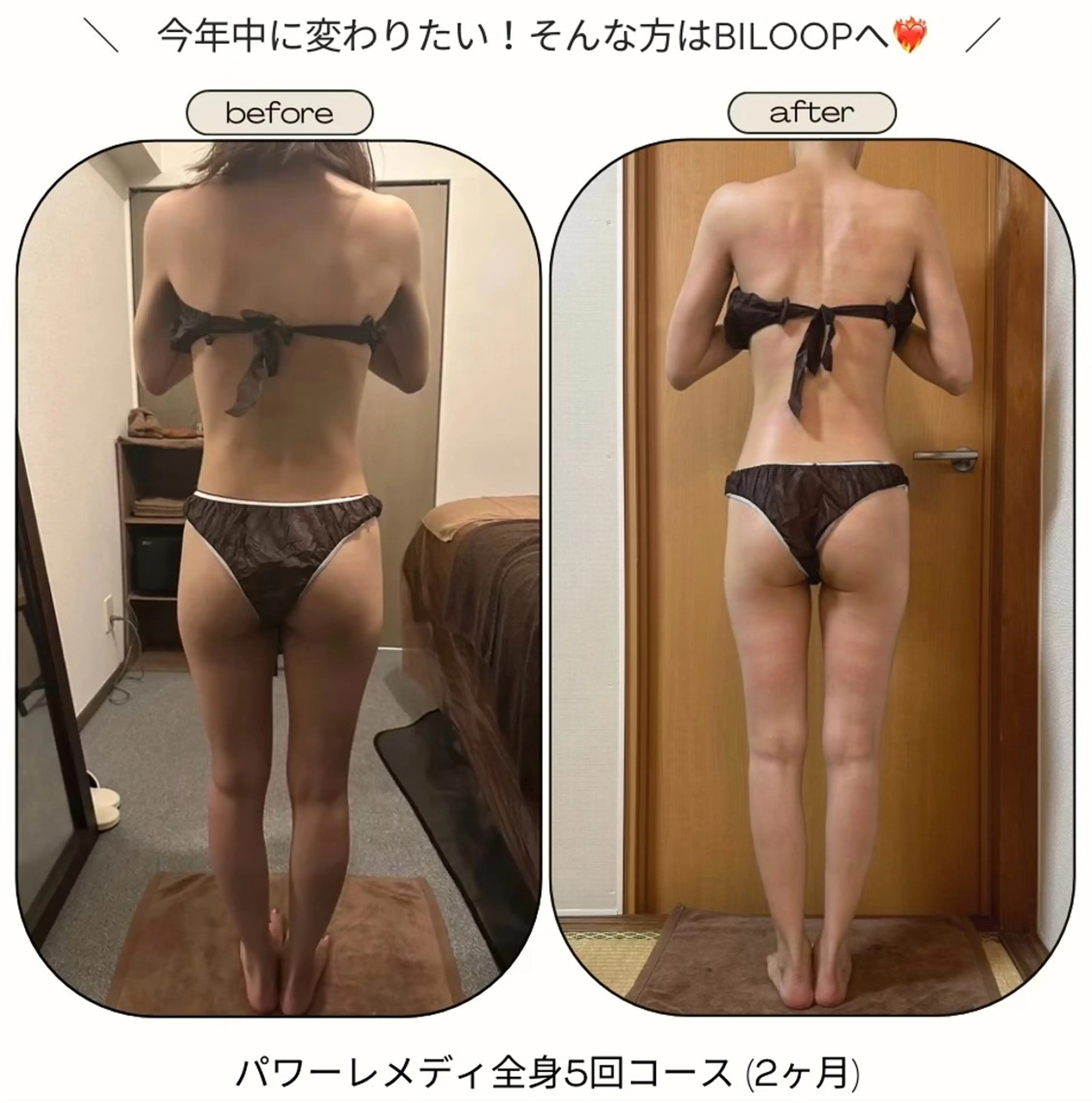 [全身５回コース] ２ヶ月で激痩せ✨発汗付き！ハンドを超える感動的な体感🌿抜群の痩身効果＋リラク🤍の写真