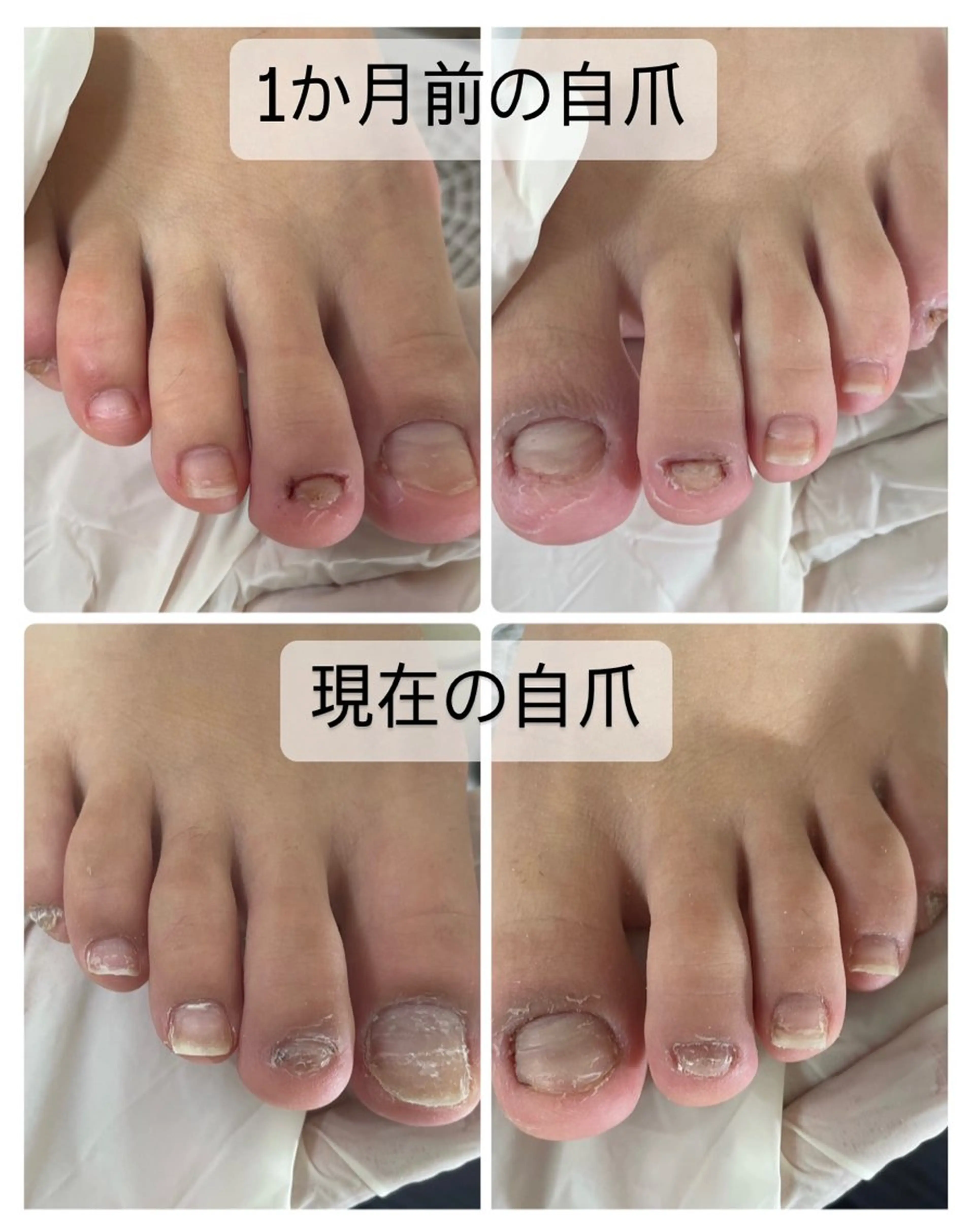 ネイル フットネイル ジェルネイル petillant所属・nail salon petillantのネイルデザイン