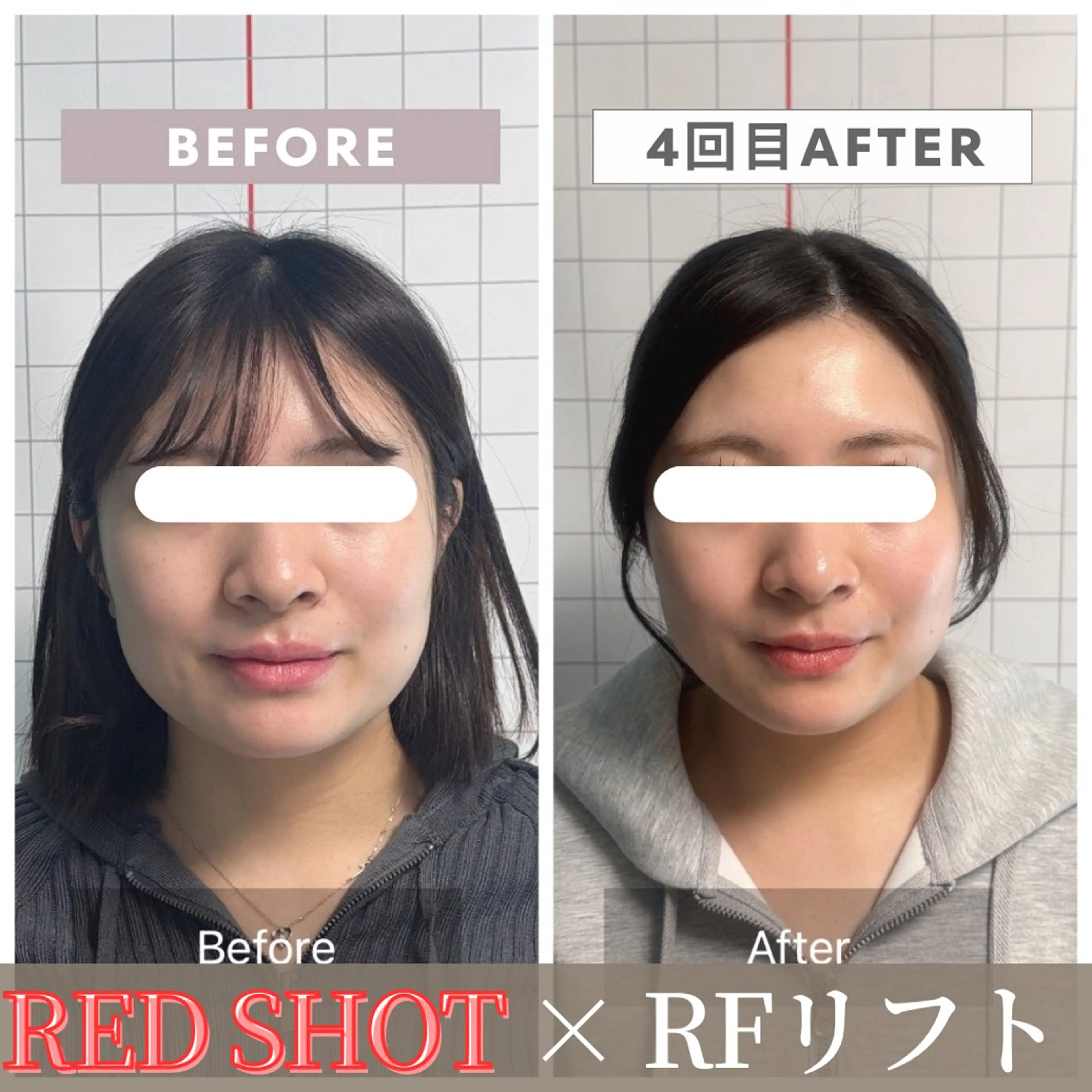 エステ リラク 小顔矯正専門店 【RED】池田のエステ・リラクイメージ