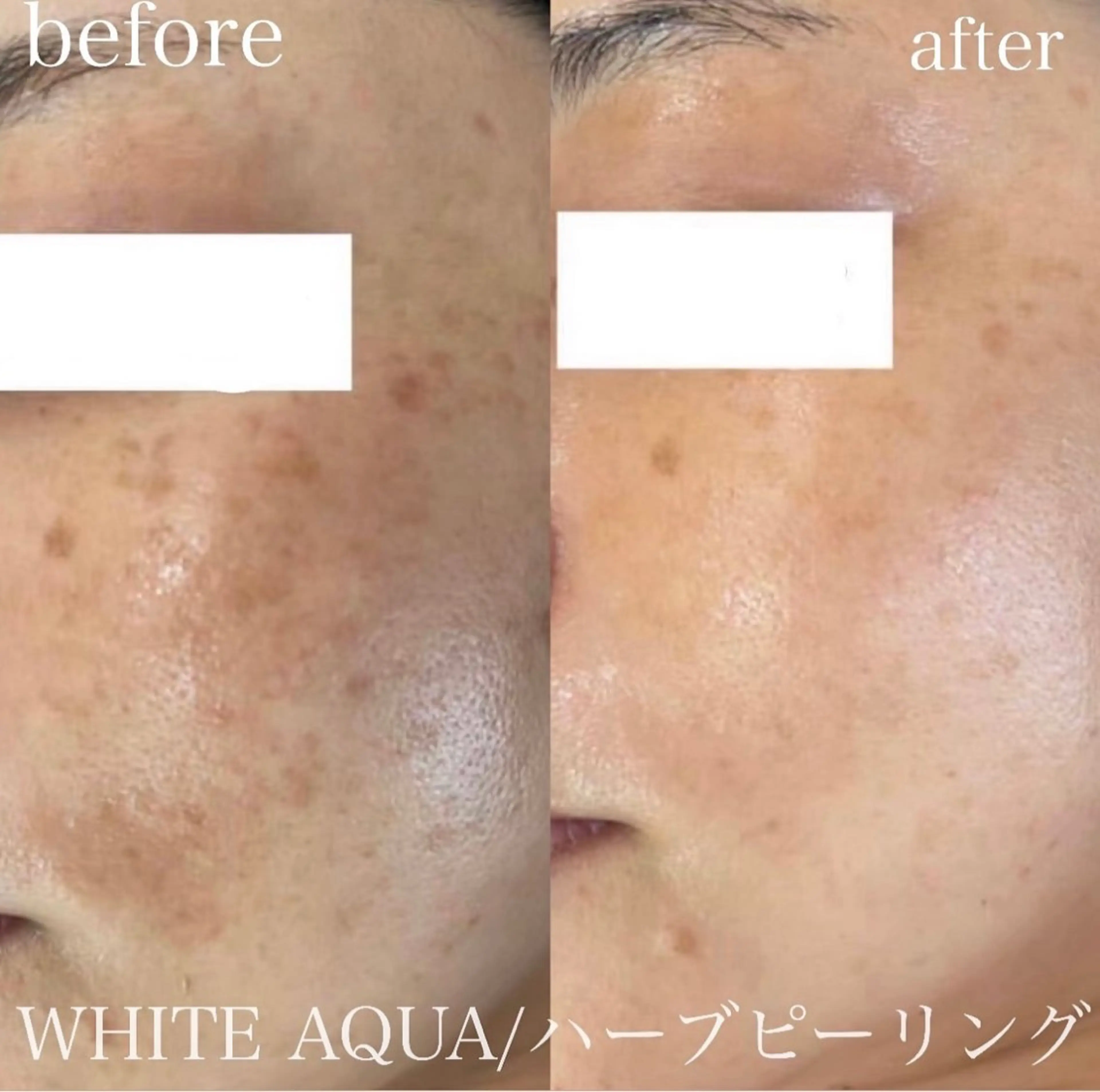 中目黒ハーブピーリン グ🌿ララピールのエステ・リラクイメージ