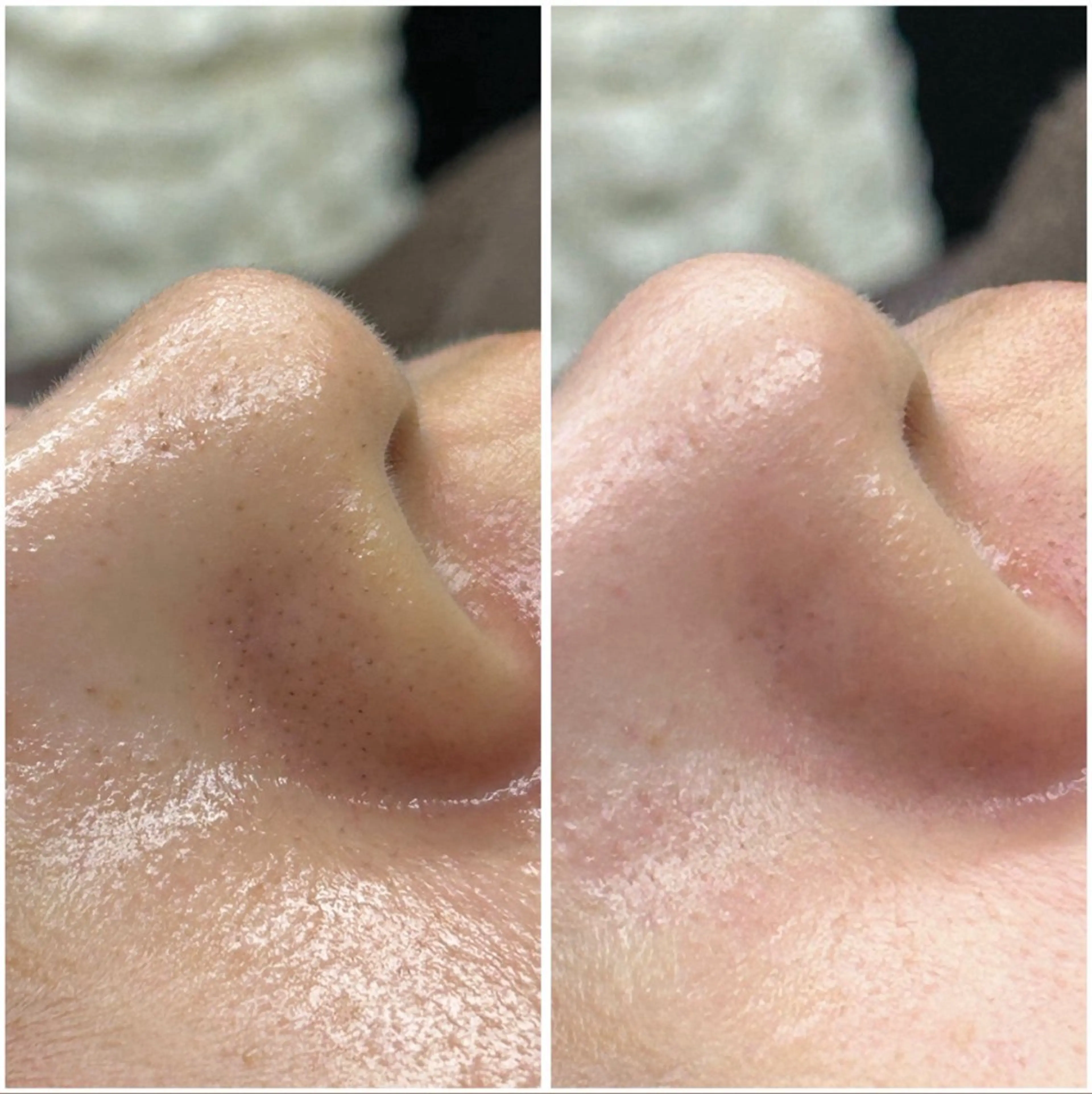 マツエク・マツパ エステ リラクゼーション＆エステランベリー所属・ランベリ ランベリのエステ・リラクイメージ