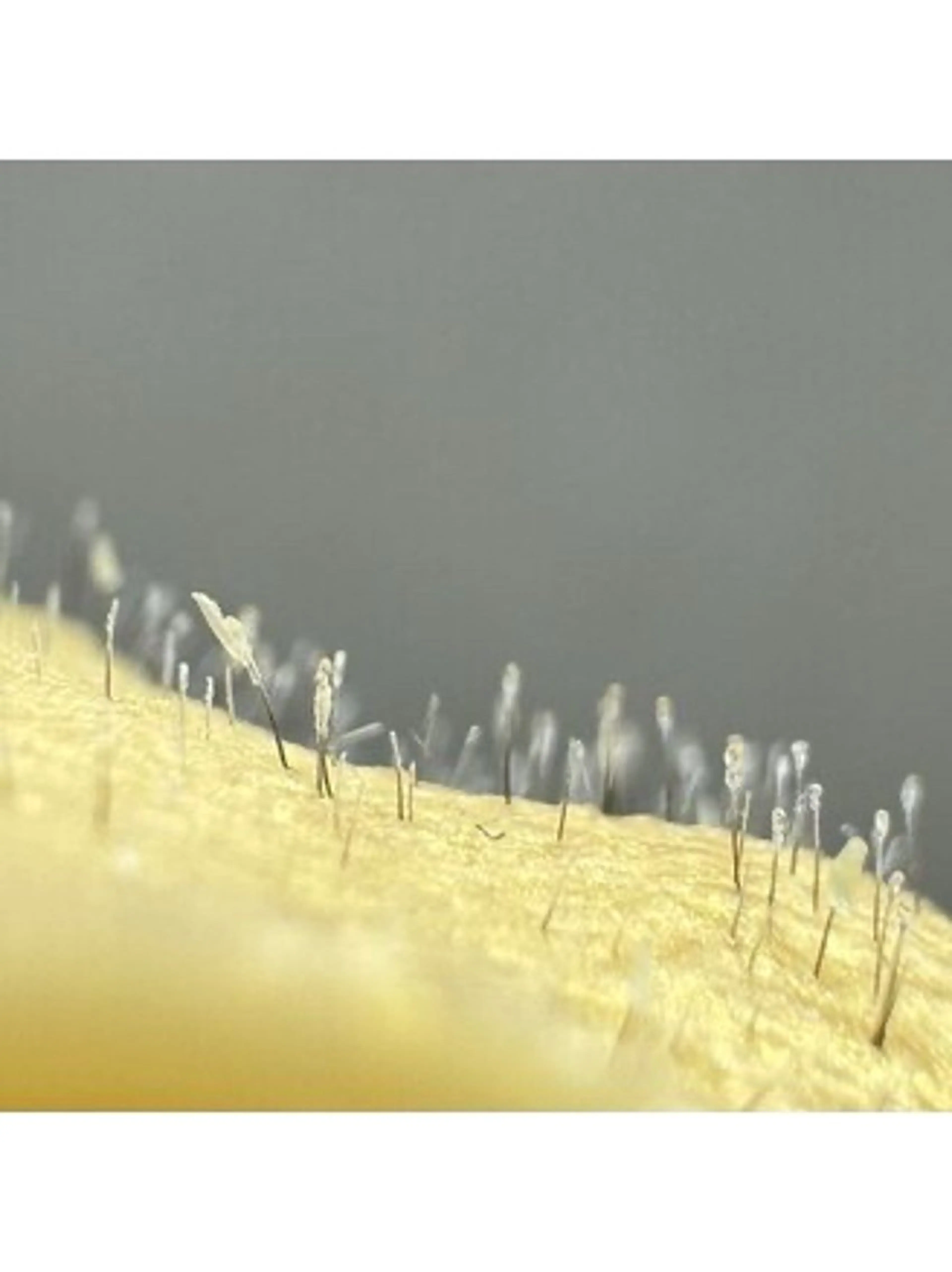 【フェイスワックス脱毛】 ツルツルお肌！黒ずみ毛穴とおさらば///化粧のノリにビックリ𓏸︎︎︎︎⁡𓈒 𓂃の写真