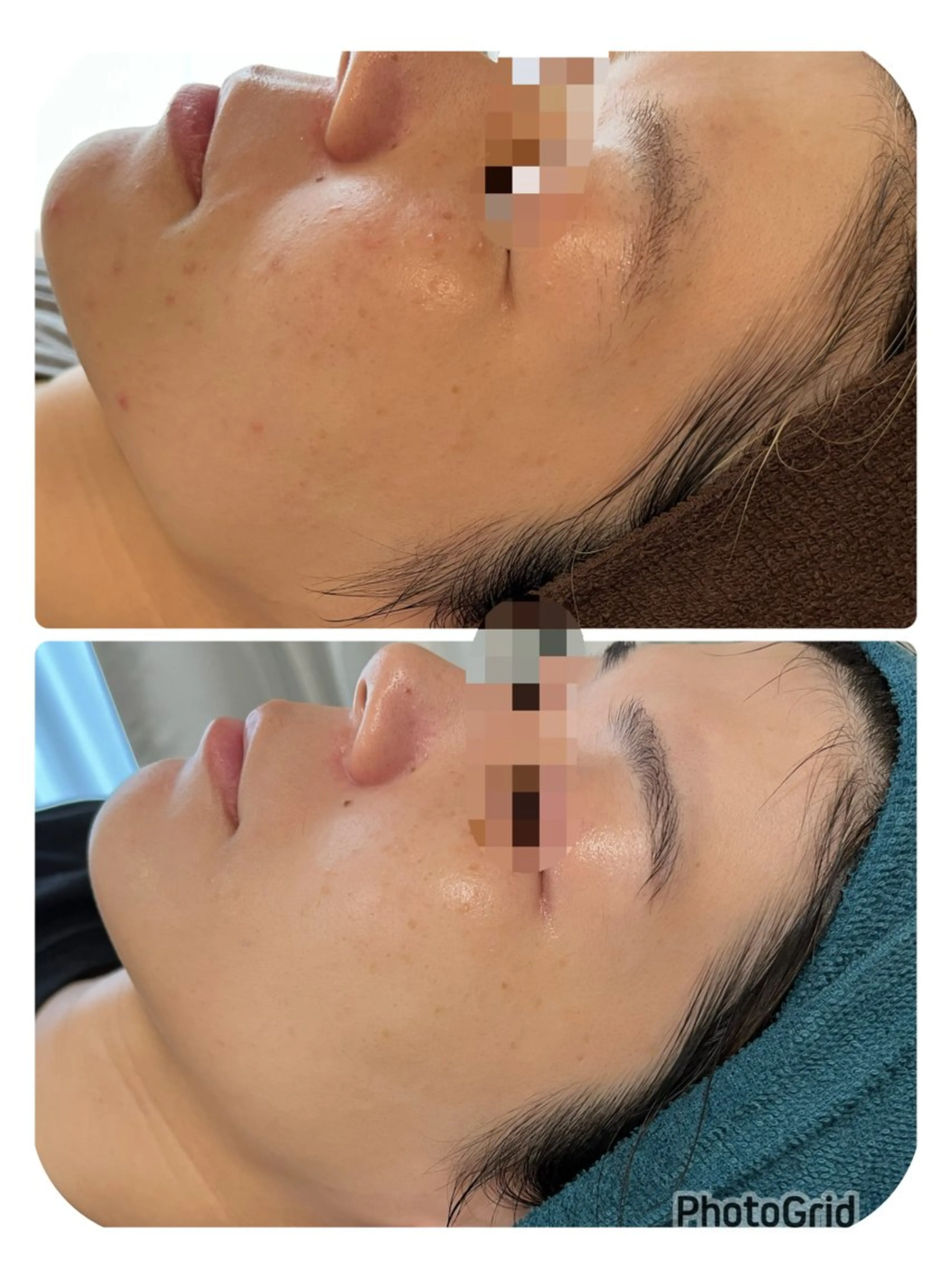 エステ 【リベルハーブピーリング認定店】敏感肌・美白脱毛専門店Dione立川店所属・Dione 立川店のエステ・リラクイメージ