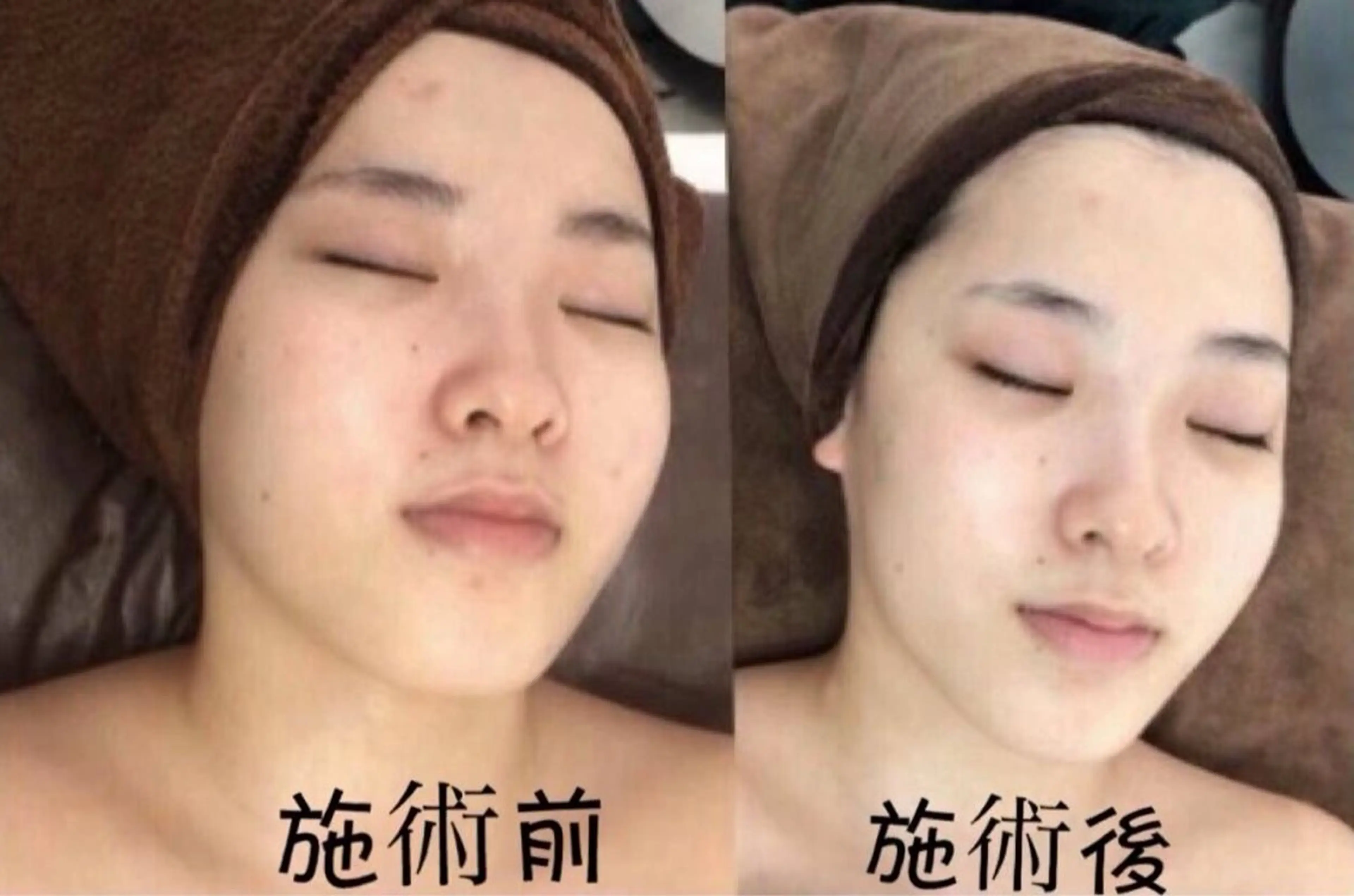 マツエク・マツパ 結婚式・ブライダル エステ aliaハイフ&水光ジェットサロン所属・aliaハーブ水光店 エステティシャン募集のエステ・リラクイメージ