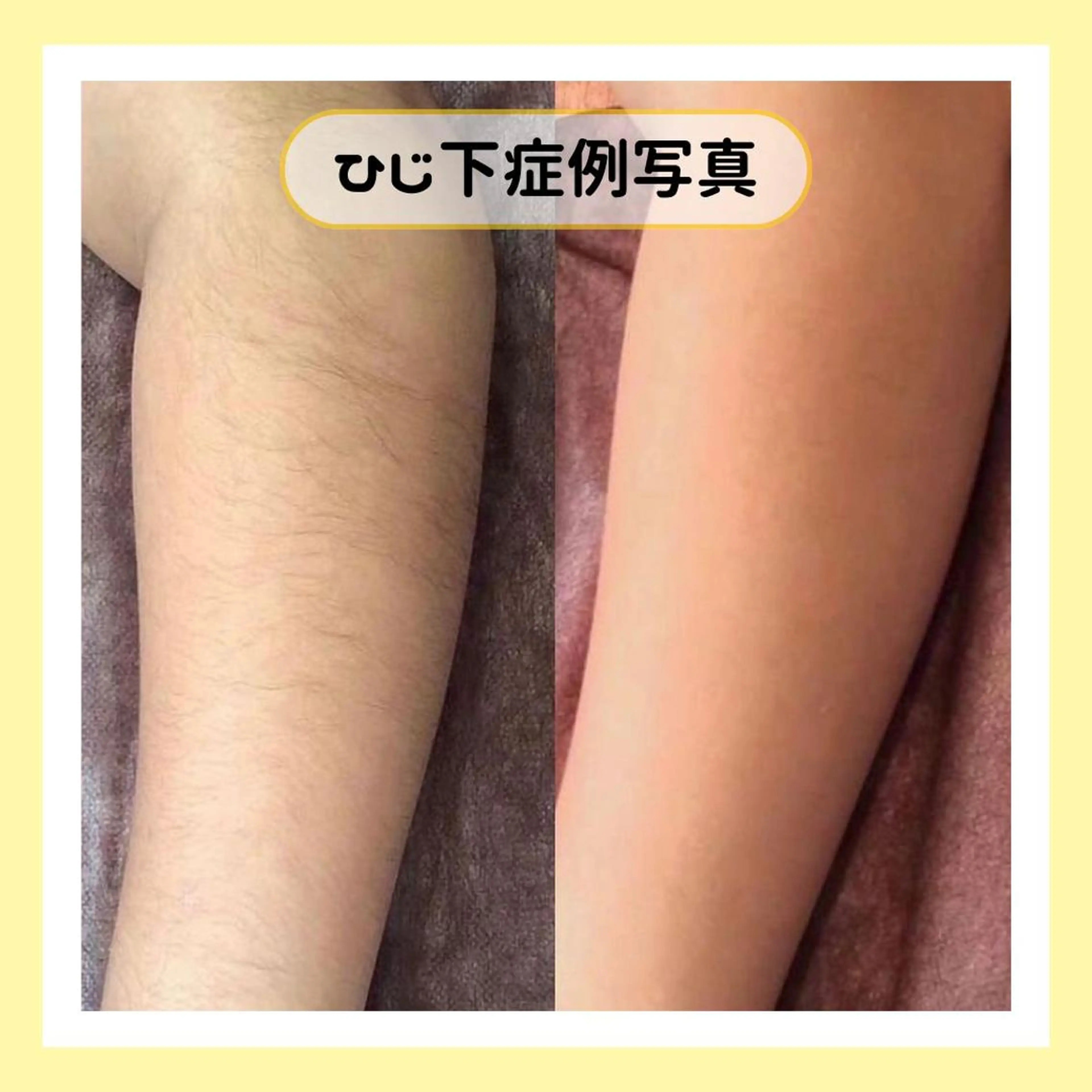 金山/脱毛/美肌 ULULUのエステ・リラクイメージ