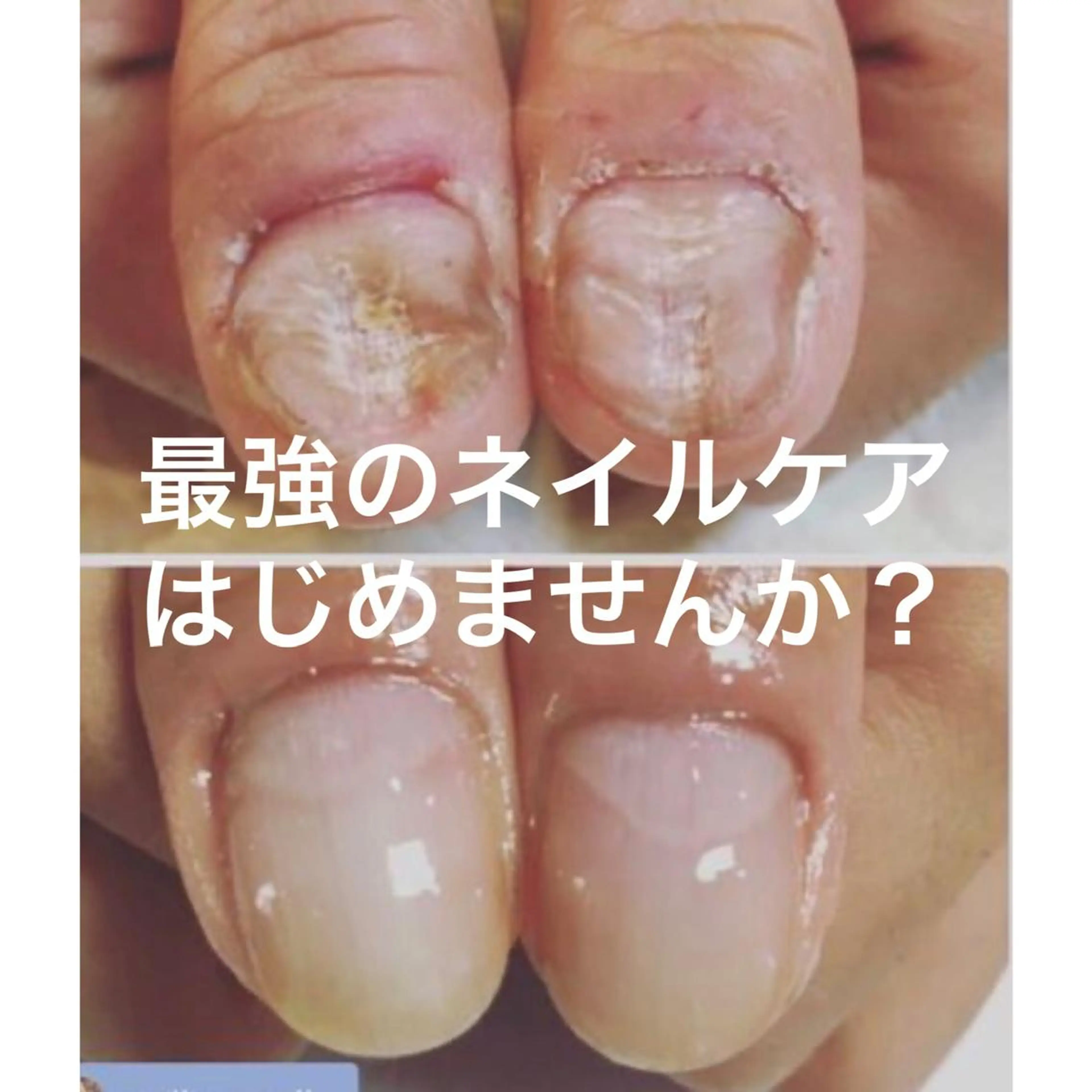 ネイル 奥園 良恵のネイルデザイン