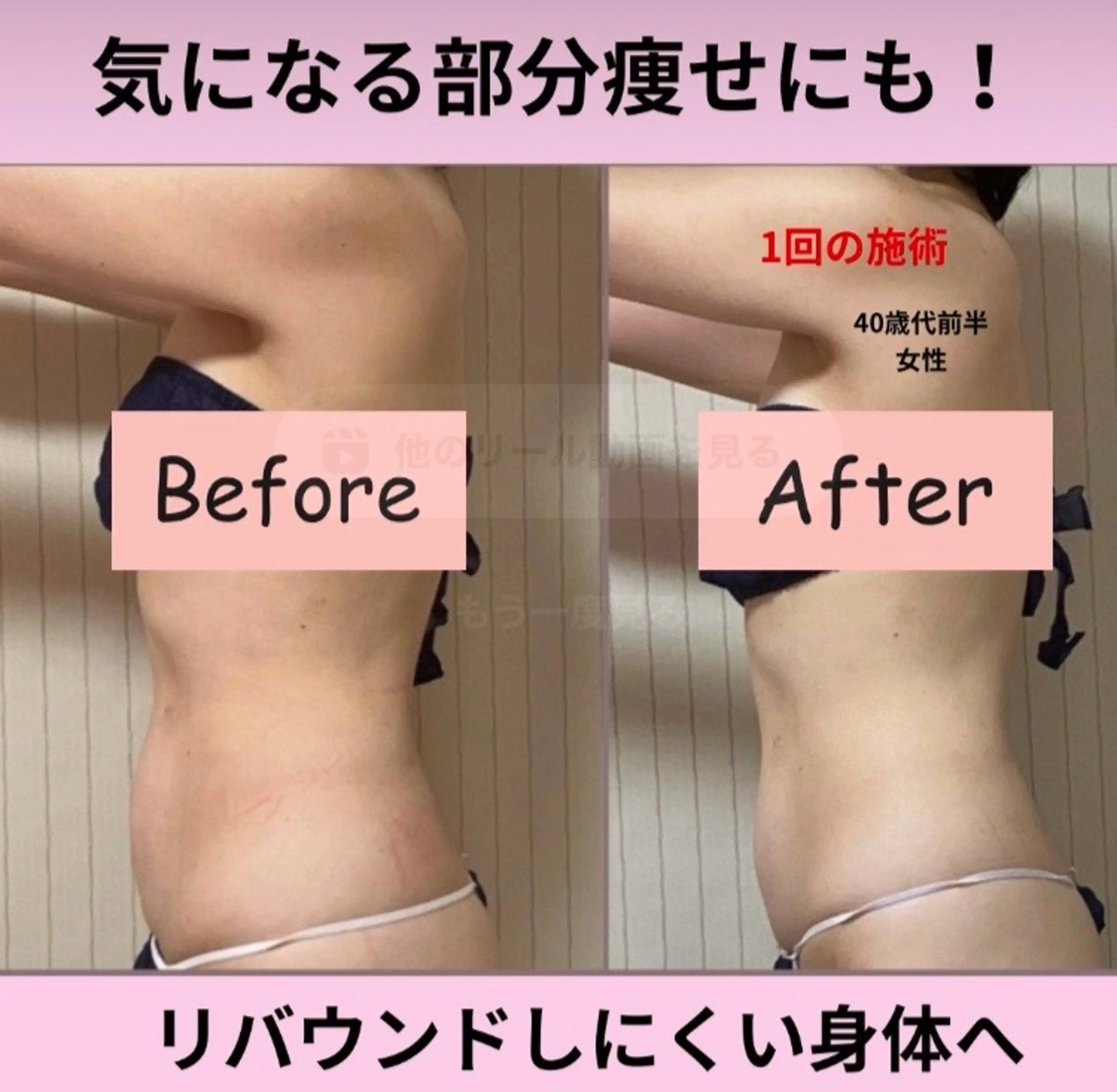 エステ akua... 【肌質管理専門】のその他イメージ