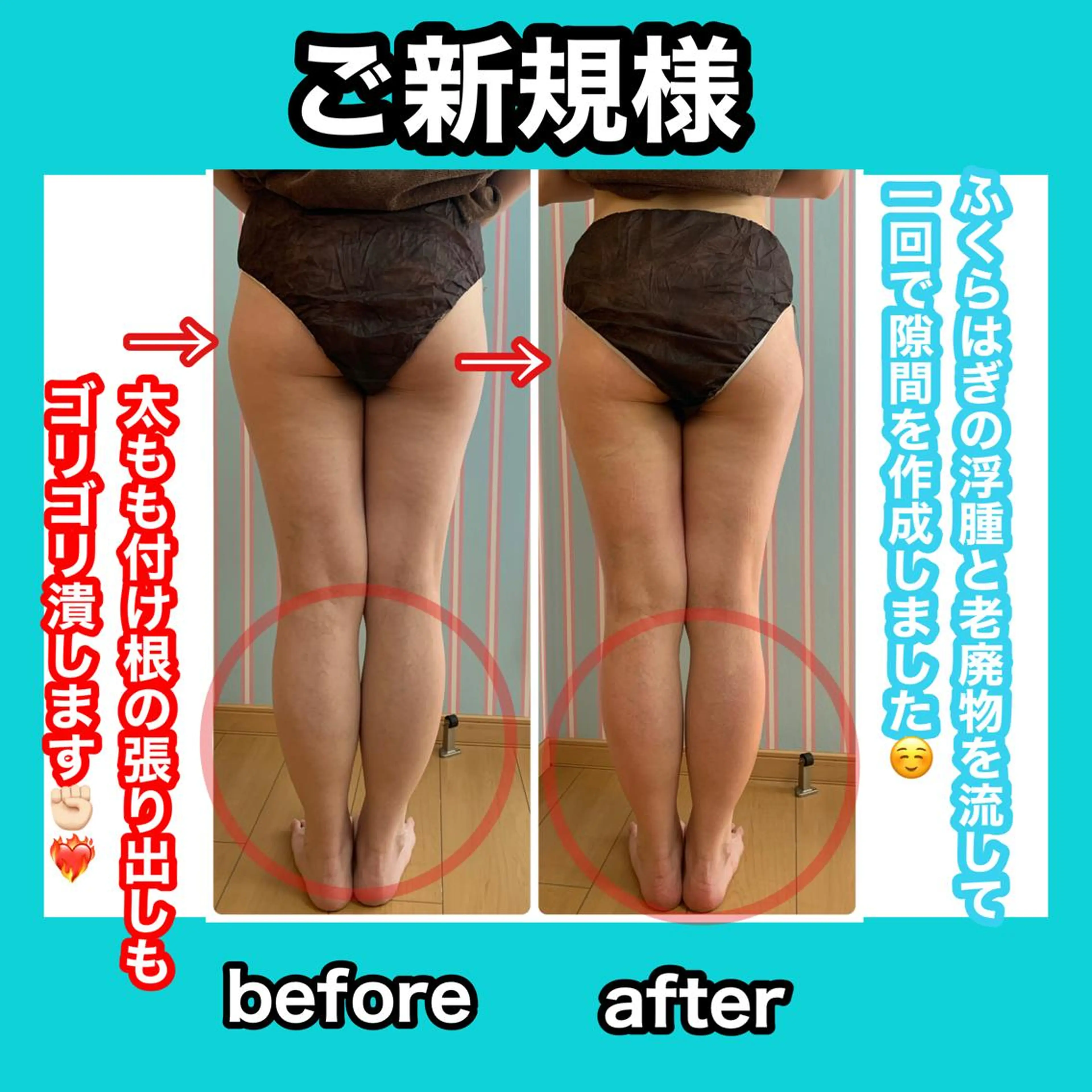 ネイル エステ リラク 痩身/脱毛/ネイル HARUKAのエステ・リラクイメージ