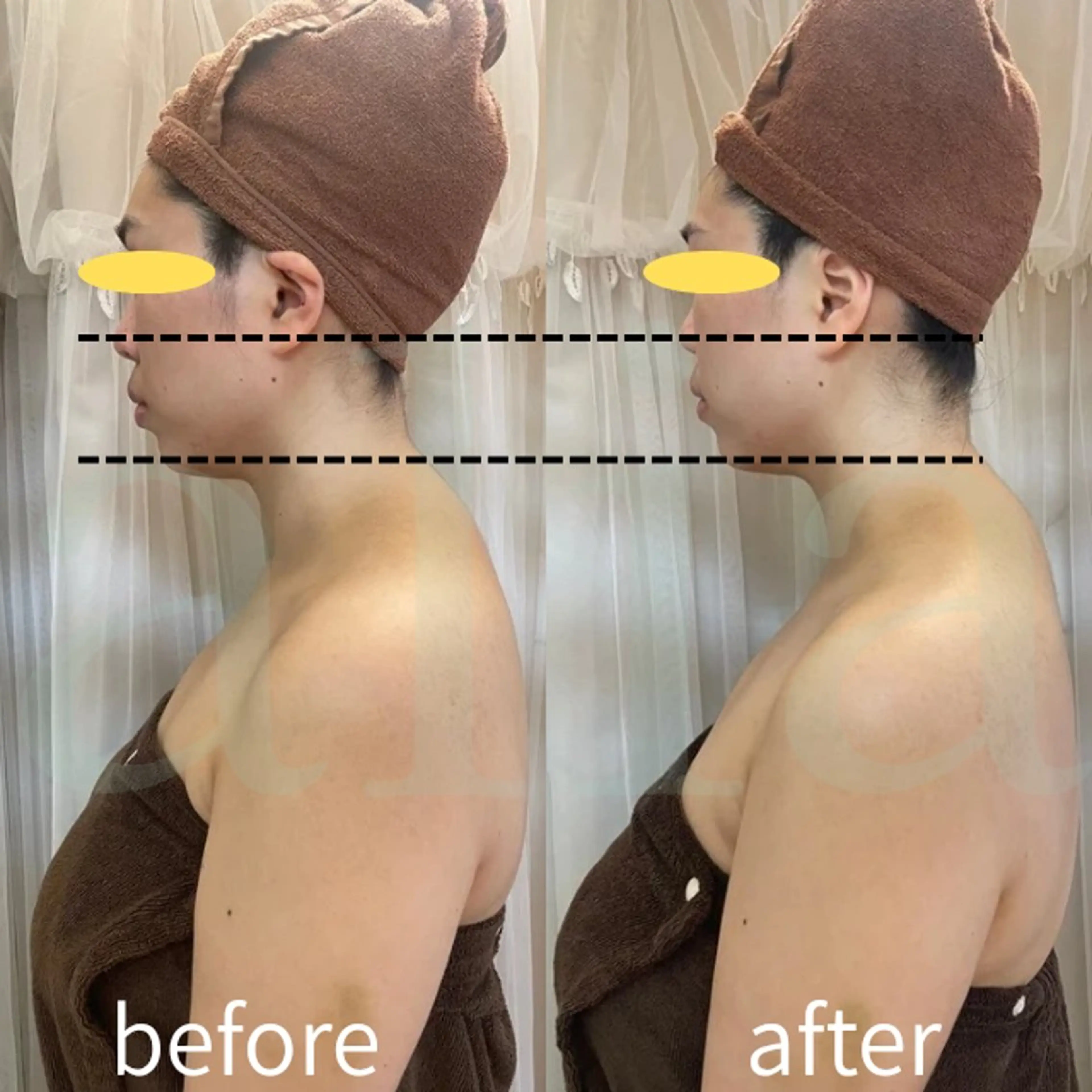 エステ aliaハイフ&水光ジェットサロン所属・aliaハーブ水光店 エステティシャン募集のエステ・リラクイメージ