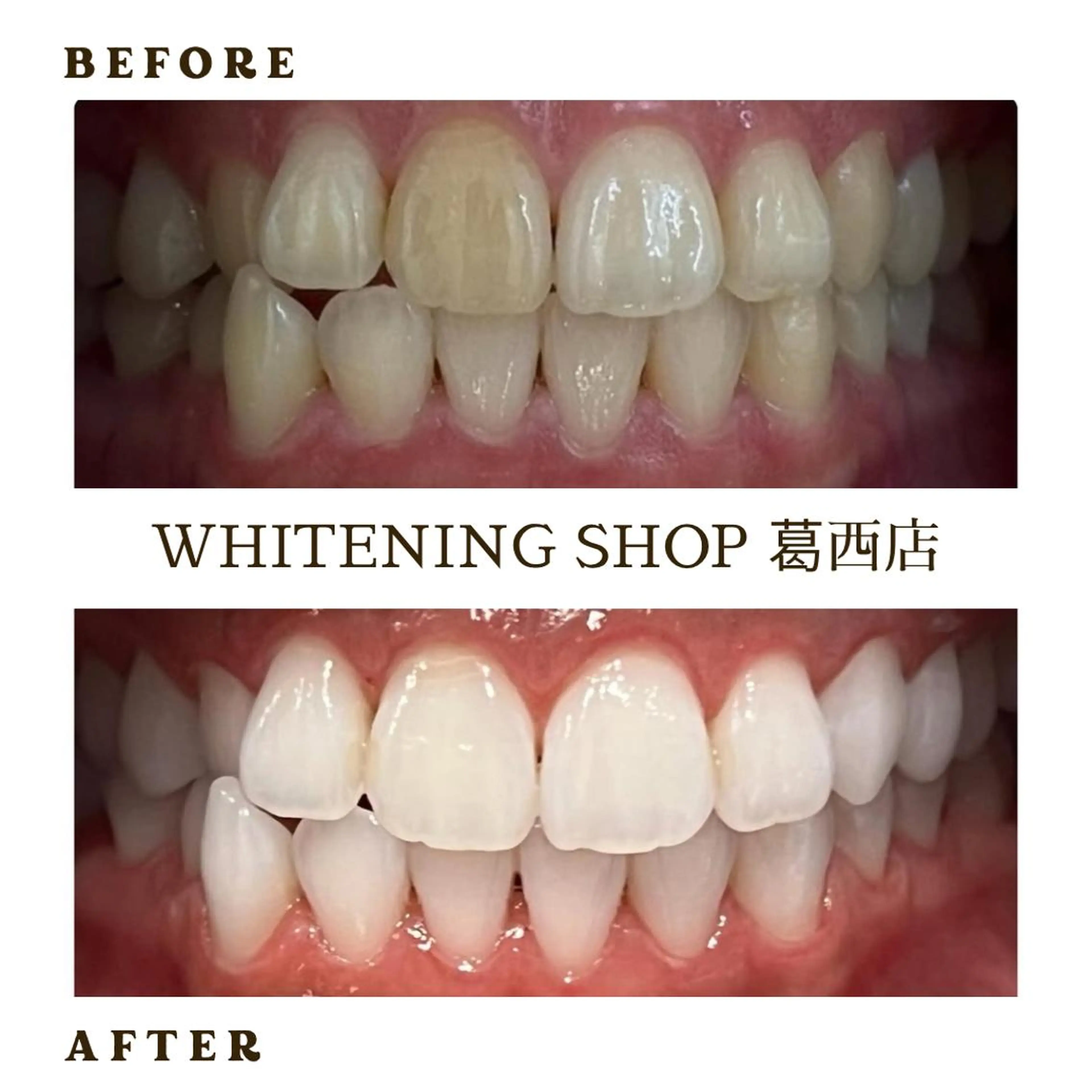 メンズ その他 ホワイトニング ショップ葛西店のその他イメージ